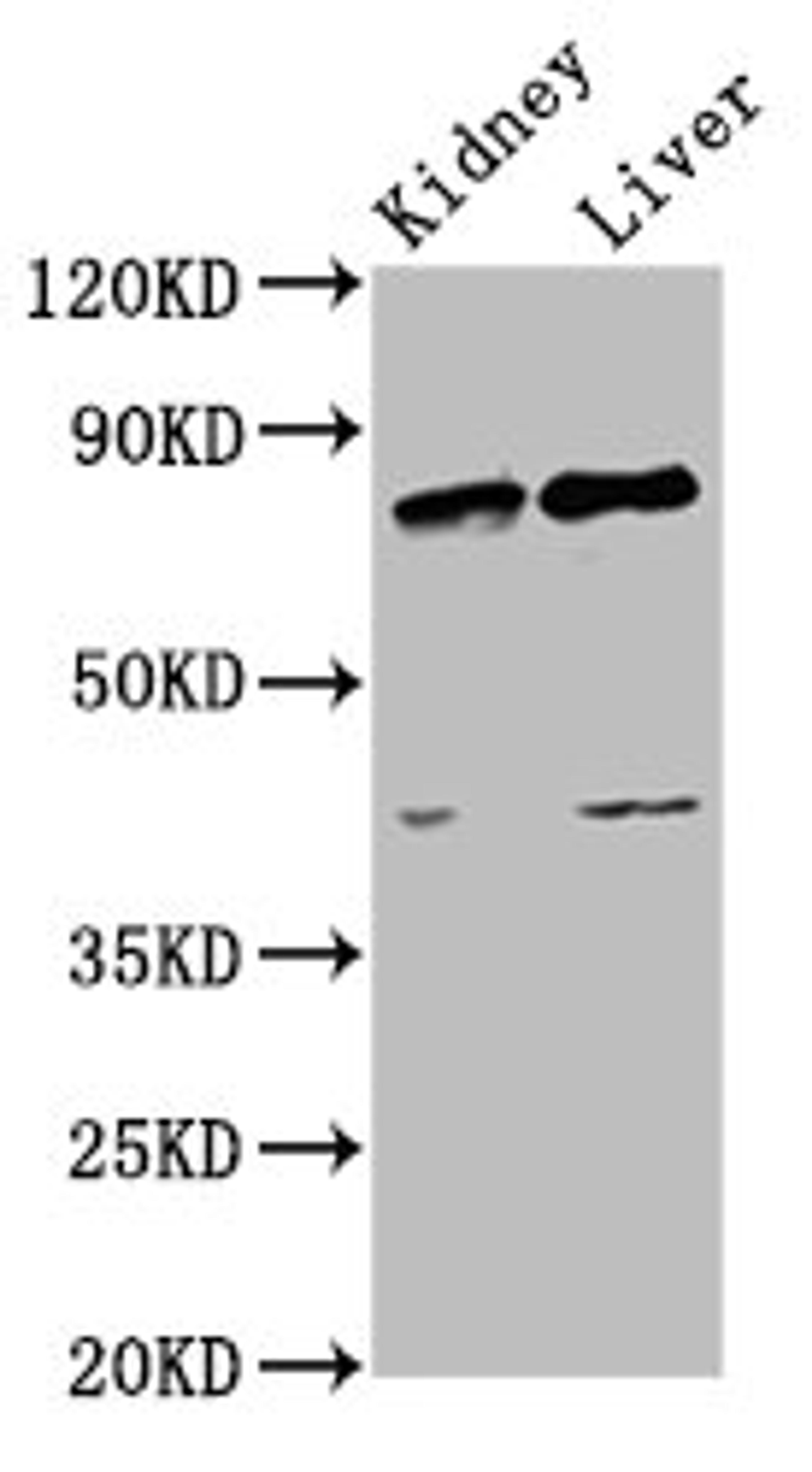 Western Blot. Positive WB detected in: Rat kidney tissue, Rat liver tissue. All lanes: SUZ12 antibody at 3.4ug/ml. Secondary. Goat polyclonal to rabbit IgG at 1/50000 dilution. Predicted band size: 84 kDa. Observed band size: 84 kDa. 