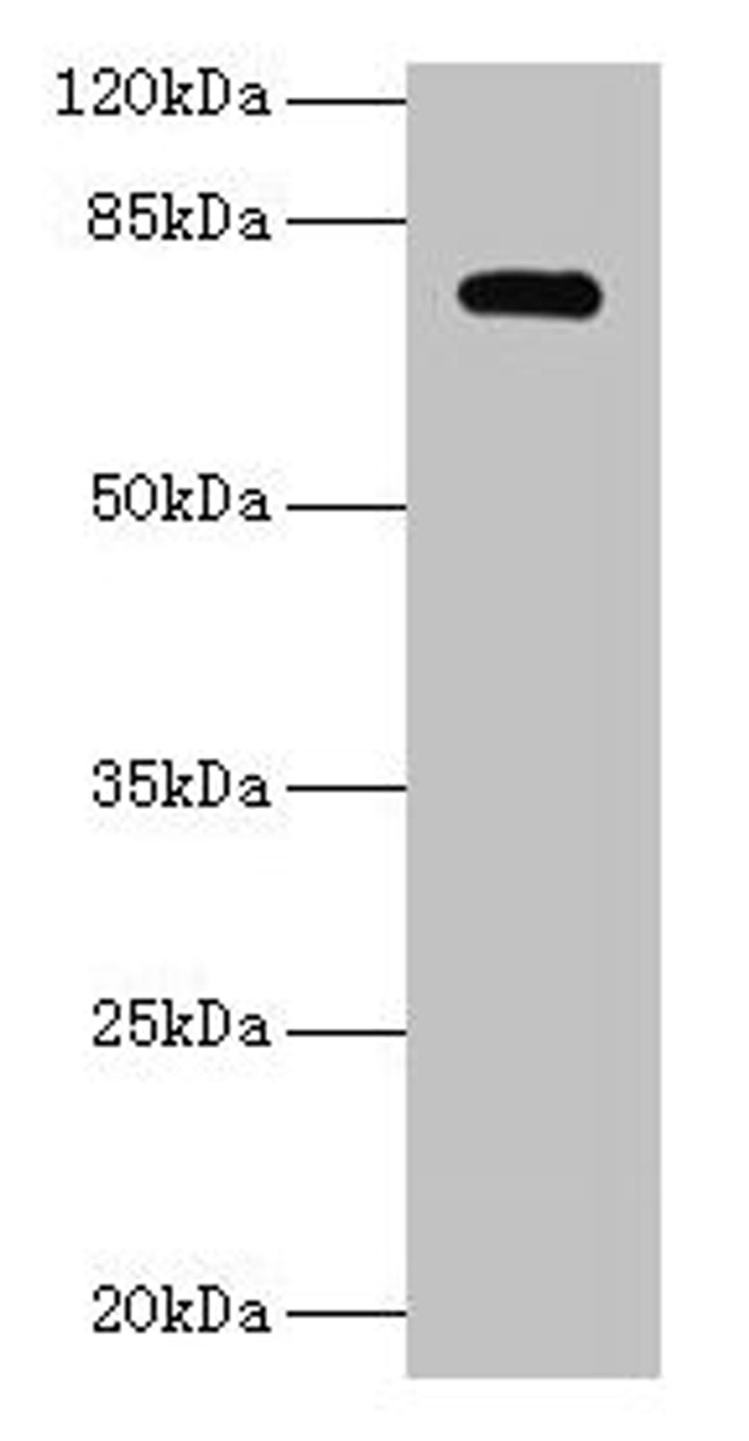 Western blot. All lanes: MON1A antibody at 2µg/ml + U251 whole cell lysate. Secondary. Goat polyclonal to rabbit IgG at 1/10000 dilution. Predicted band size: 73, 45, 34, 56, 63 kDa. Observed band size: 73 kDa