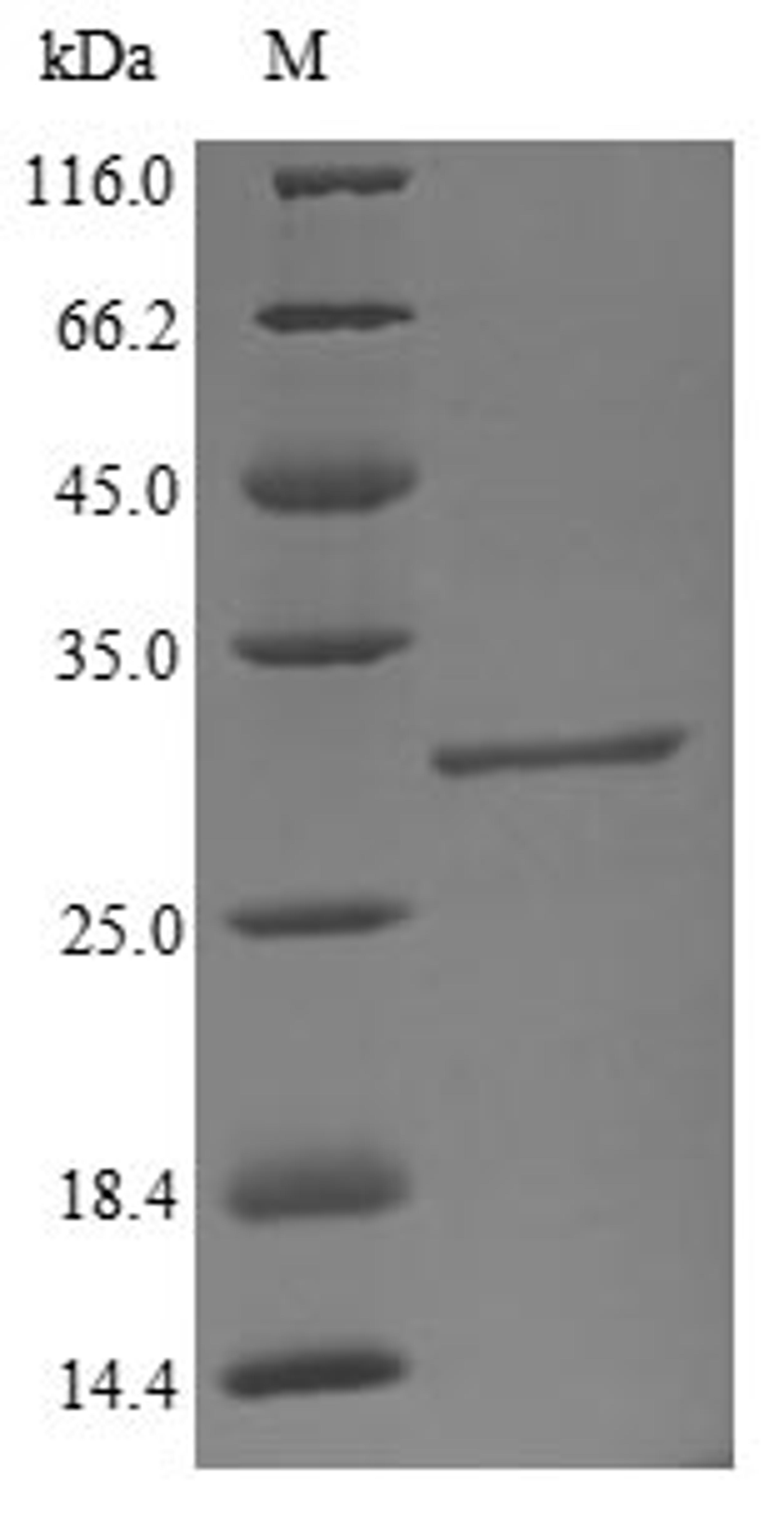 (Tris-Glycine gel) Discontinuous SDS-PAGE (reduced) with 5% enrichment gel and 15% separation gel.