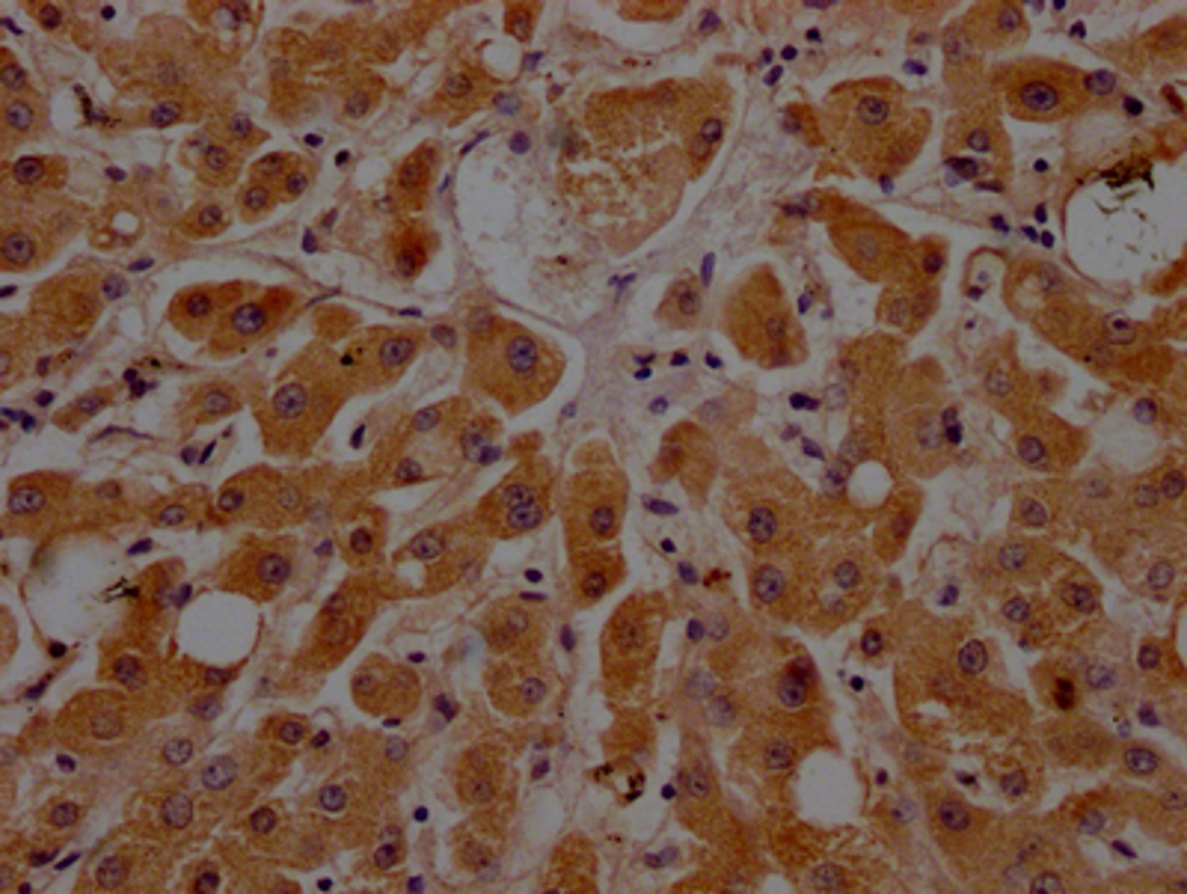 IHC image of CSB-RA925915A0HU diluted at 1:100 and staining in paraffin-embedded human liver tissue performed on a Leica BondTM system. After dewaxing and hydration, antigen retrieval was mediated by high pressure in a citrate buffer (pH 6.0). Section was blocked with 10% normal goat serum 30min at RT. Then primary antibody (1% BSA) was incubated at 4℃ overnight. The primary is detected by a Goat anti-rabbit IgG polymer labeled by HRP and visualized using 0.05% DAB.