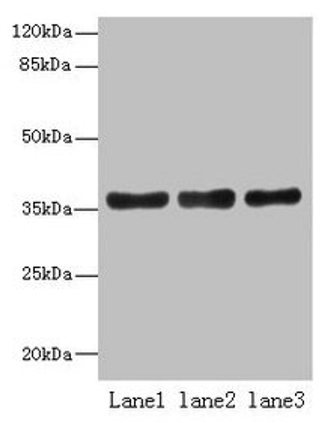 Western blot. All lanes: UPP2 antibody at 4µg/ml. Lane 1: Mouse kidney tissue. Lane 2: Mouse brain tissue. Lane 3: Hela whole cell lysate. Secondary. Goat polyclonal to rabbit IgG at 1/10000 dilution. Predicted band size: 36, 42 kDa. Observed band size: 36 kDa