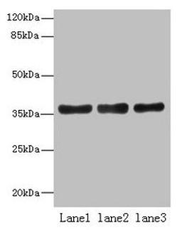 Western blot. All lanes: UPP2 antibody at 4µg/ml. Lane 1: Mouse kidney tissue. Lane 2: Mouse brain tissue. Lane 3: Hela whole cell lysate. Secondary. Goat polyclonal to rabbit IgG at 1/10000 dilution. Predicted band size: 36, 42 kDa. Observed band size: 36 kDa