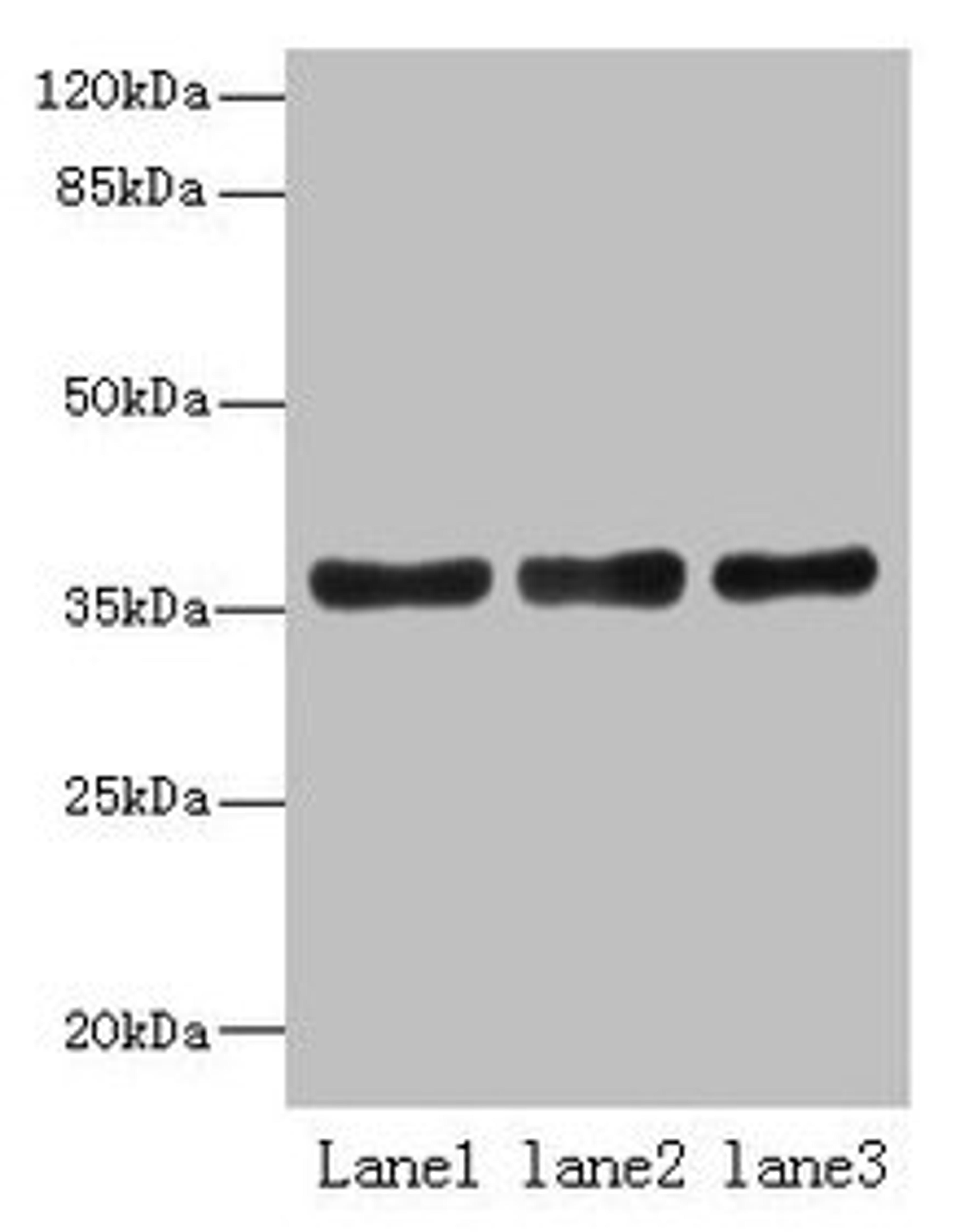 Western blot. All lanes: UPP2 antibody at 4µg/ml. Lane 1: Mouse kidney tissue. Lane 2: Mouse brain tissue. Lane 3: Hela whole cell lysate. Secondary. Goat polyclonal to rabbit IgG at 1/10000 dilution. Predicted band size: 36, 42 kDa. Observed band size: 36 kDa