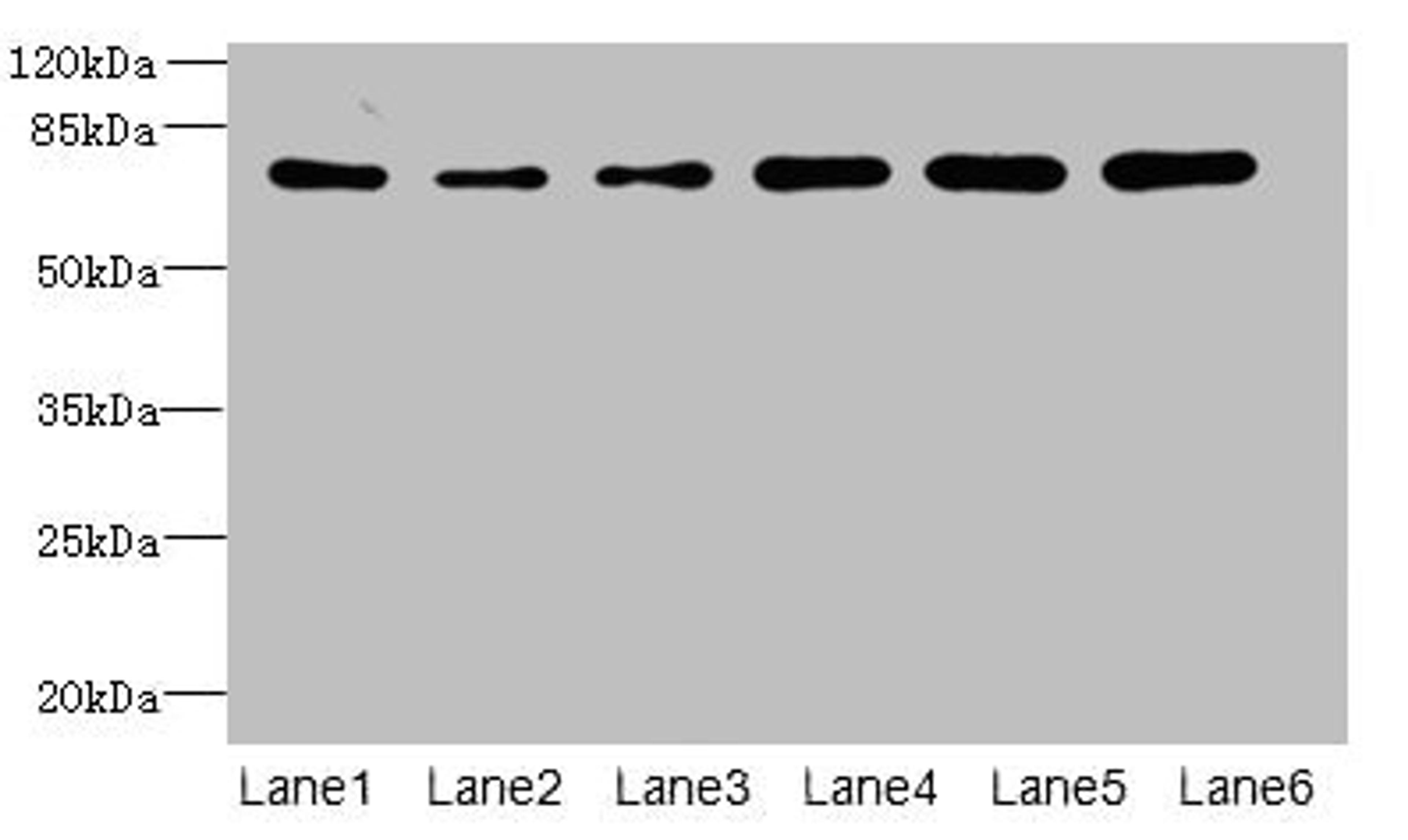 Western blot. All lanes: ZNF555 antibody at 2µg/ml. Lane 1: HepG2 whole cell lysate. Lane 2: 293T whole cell lysate. Lane 3: Hela whole cell lysate. Lane 4: Jurkat whole cell lysate. Lane 5: Mouse liver tissue. Lane 6: HL60 whole cell lysate. Secondary. Goat polyclonal to rabbit IgG at 1/10000 dilution. Predicted band size: 74, 64, 73 kDa. Observed band size: 74 kDa