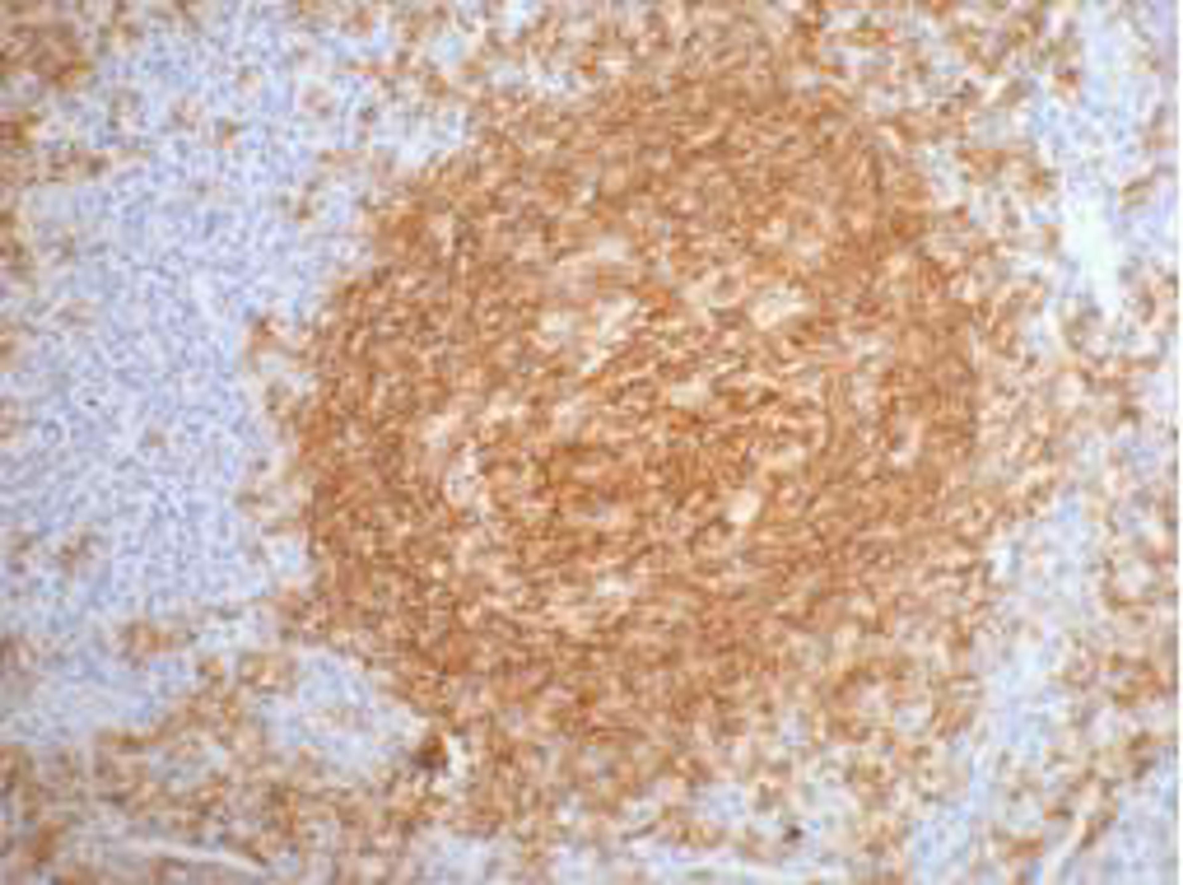 IHC staining of Human tonsil tissue paraffin-embedded, diluted at 1:200.