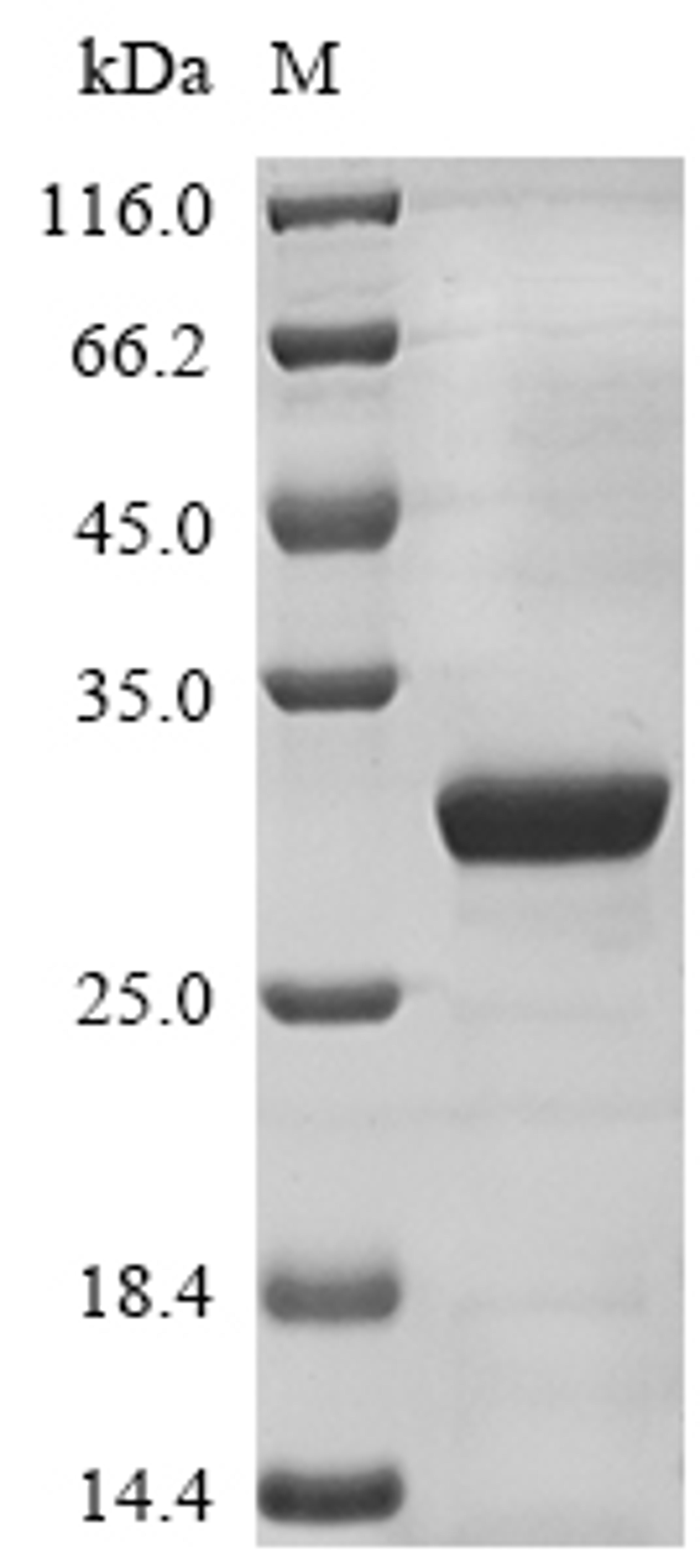 (Tris-Glycine gel) Discontinuous SDS-PAGE (reduced) with 5% enrichment gel and 15% separation gel.