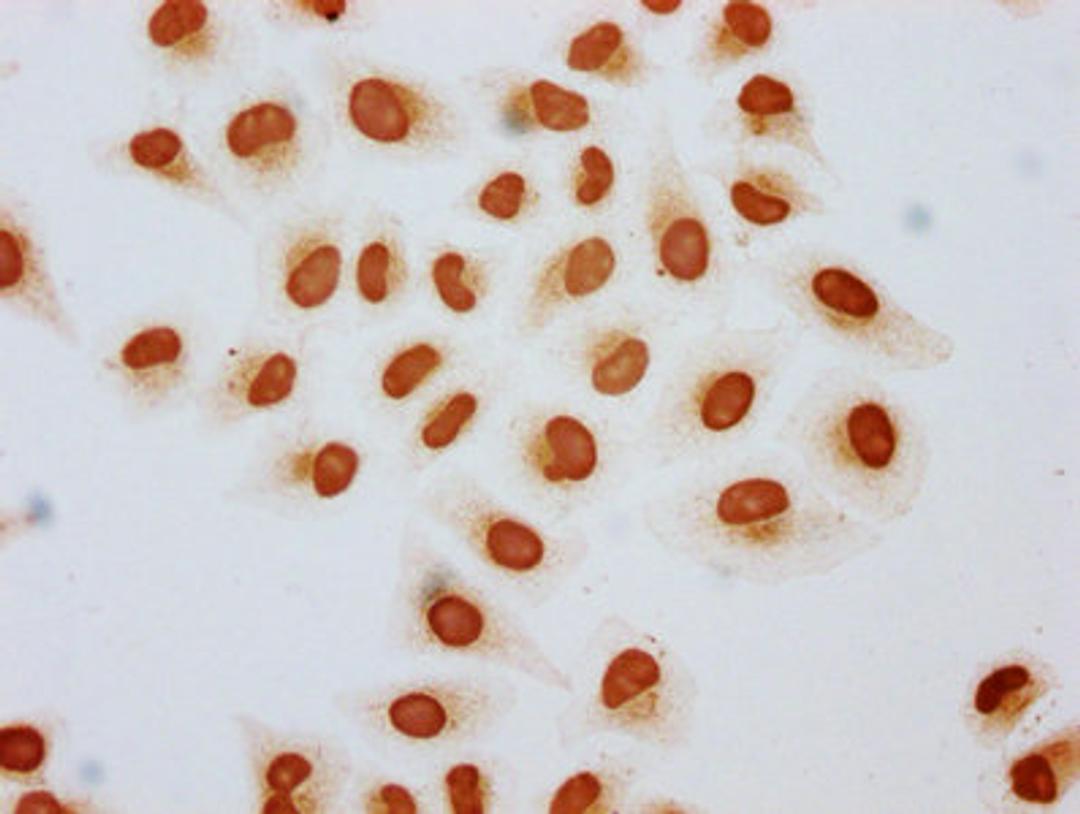 Immunocytochemistry analysis of CSB-PA010389OA15acHU diluted at 1:3 and staining in Hela cells (treated with 30mM sodium butyrate for 4h) performed on a Leica BondTM system. The cells were fixed in 4% formaldehyde, permeabilized using 0.2% Triton X-100 and blocked with 10% normal goat serum 30min at RT. Then primary antibody (1% BSA) was incubated at 4&deg;C overnight. The primary is detected by a biotinylated secondary antibody and visualized using an HRP conjugated SP system.