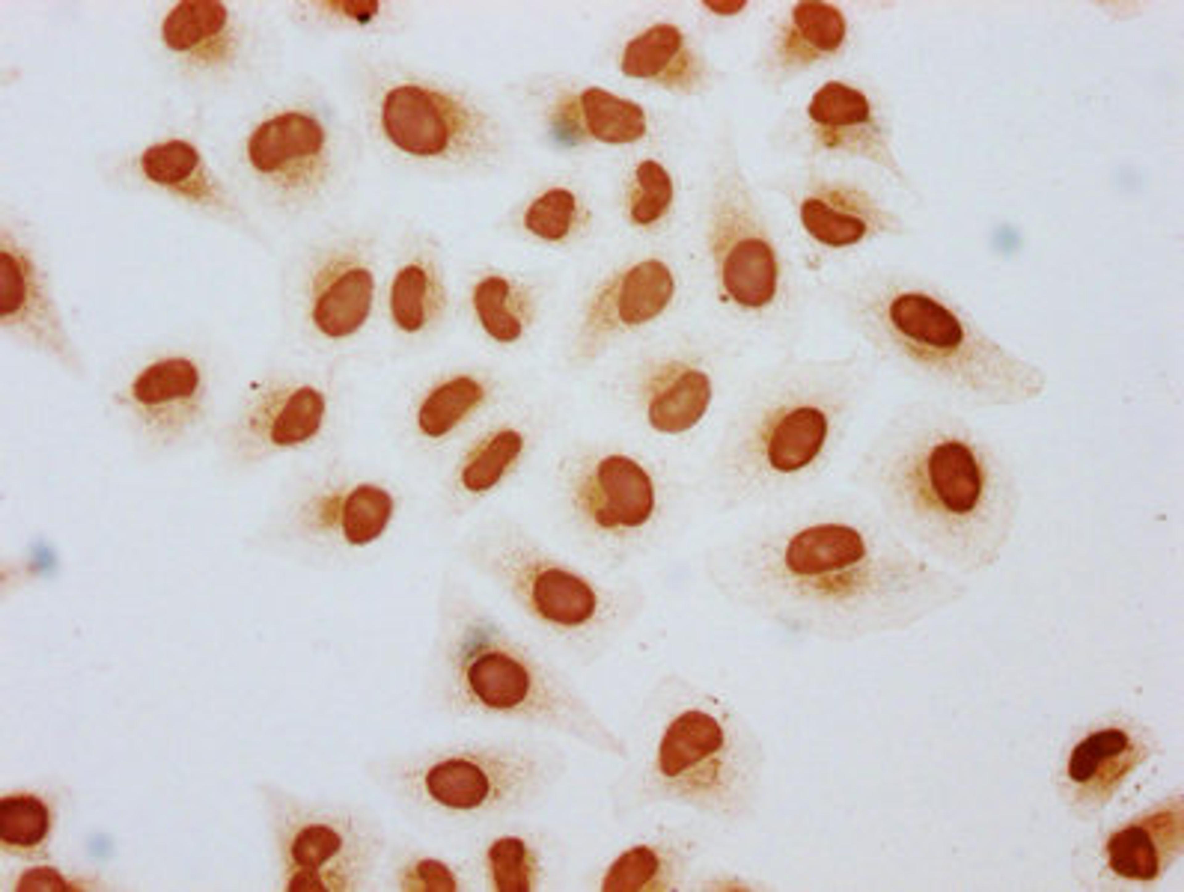 Immunocytochemistry analysis of CSB-PA010389OA15acHU diluted at 1:3 and staining in Hela cells (treated with 30mM sodium butyrate for 4h) performed on a Leica BondTM system. The cells were fixed in 4% formaldehyde, permeabilized using 0.2% Triton X-100 and blocked with 10% normal goat serum 30min at RT. Then primary antibody (1% BSA) was incubated at 4&deg;C overnight. The primary is detected by a biotinylated secondary antibody and visualized using an HRP conjugated SP system.