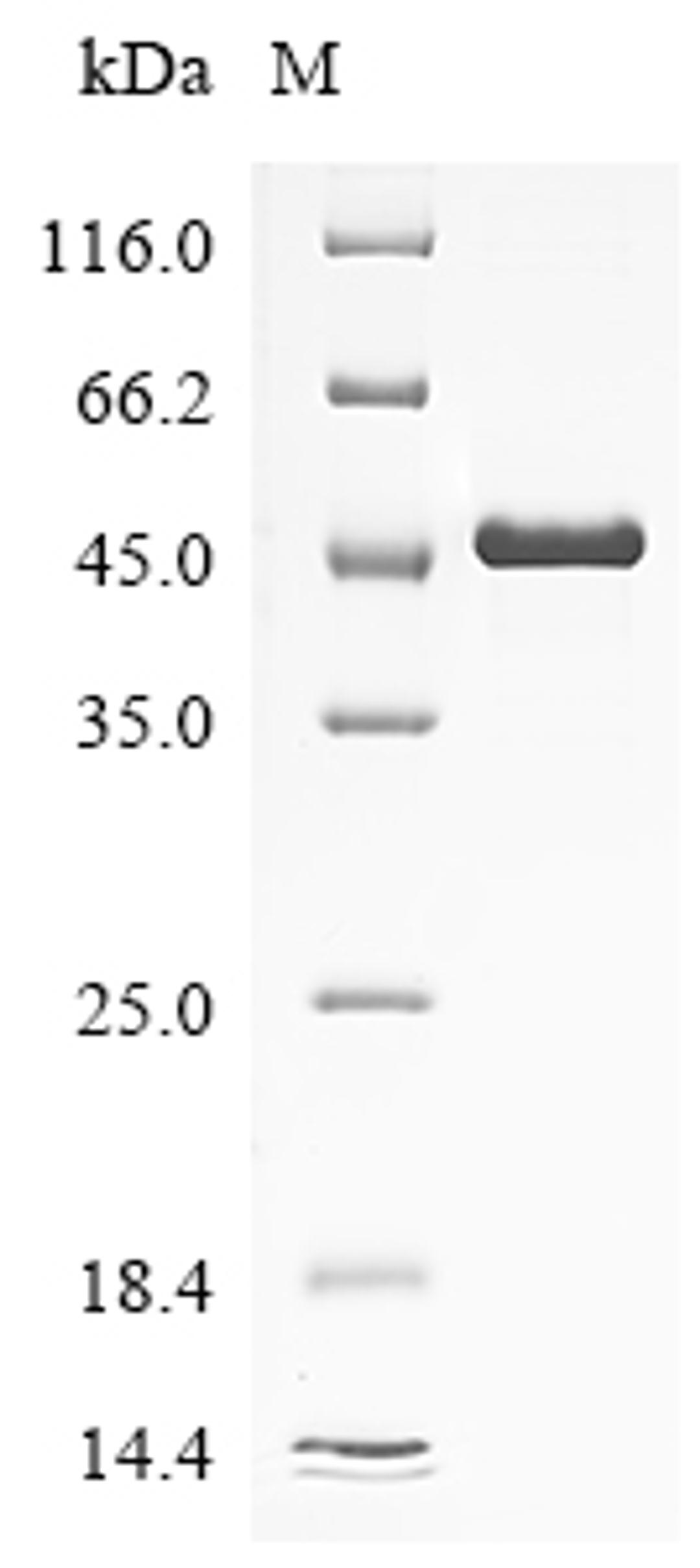 (Tris-Glycine gel) Discontinuous SDS-PAGE (reduced) with 5% enrichment gel and 15% separation gel.