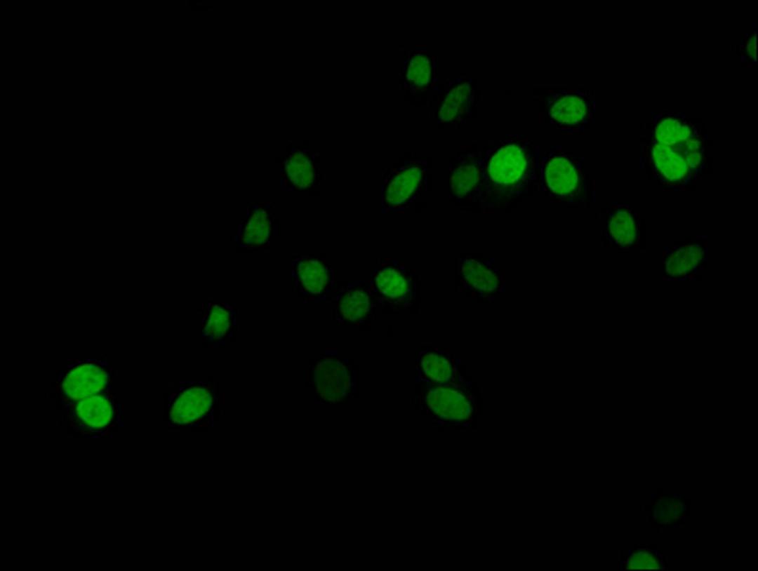 Immunofluorescent analysis of Hela cells (treated with 30mM crotonylate for 4h) using CSB-PA010389PA125crHU at dilution of 1:100 and Alexa Fluor 488-congugated AffiniPure Goat Anti-Rabbit IgG(H+L)