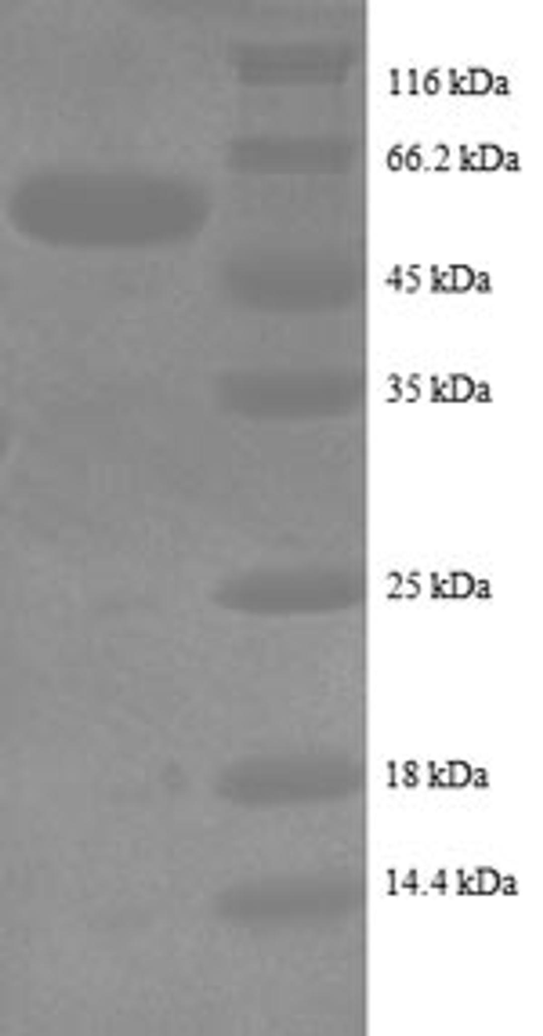 (Tris-Glycine gel) Discontinuous SDS-PAGE (reduced) with 5% enrichment gel and 15% separation gel.