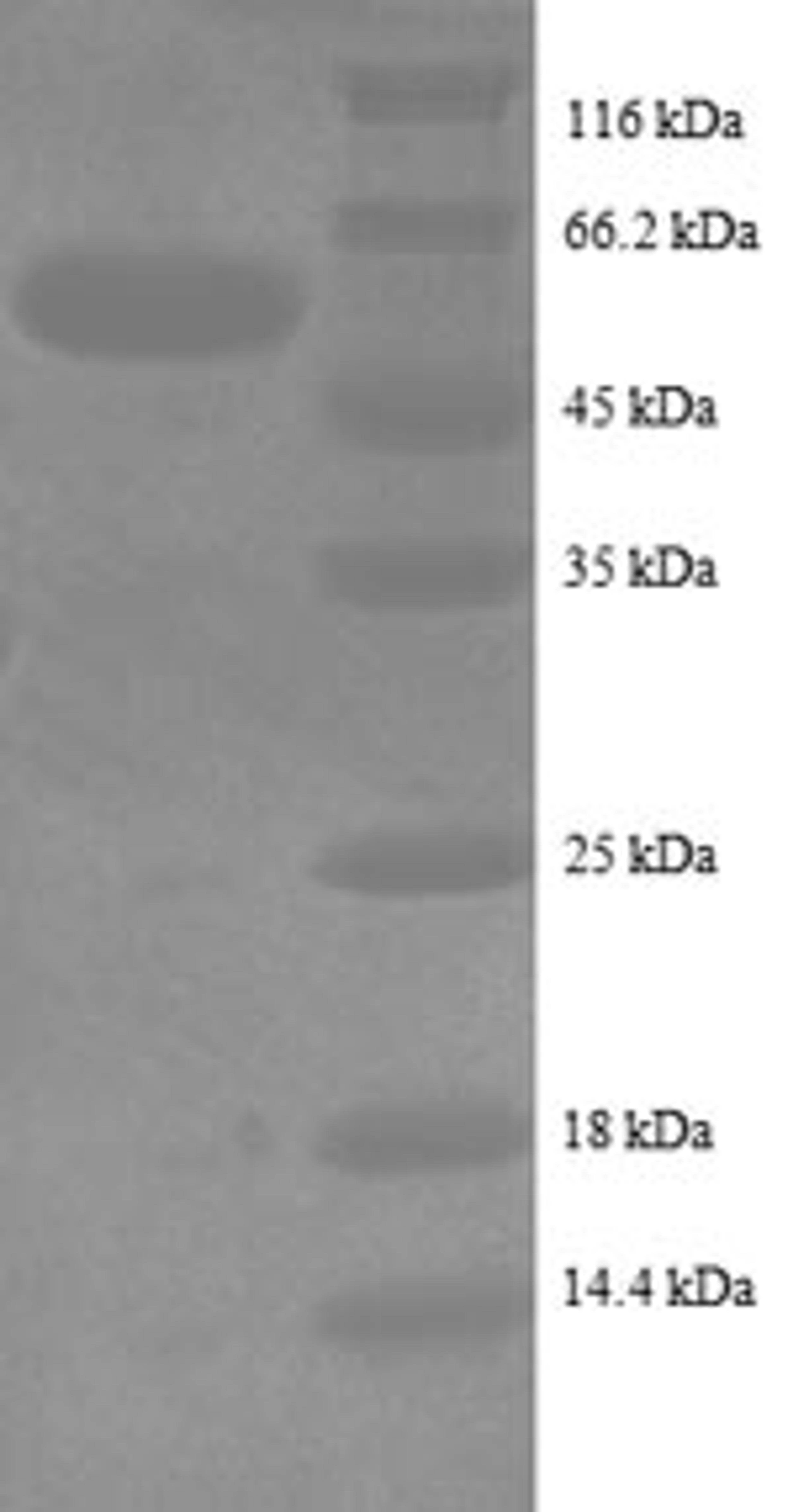 (Tris-Glycine gel) Discontinuous SDS-PAGE (reduced) with 5% enrichment gel and 15% separation gel.