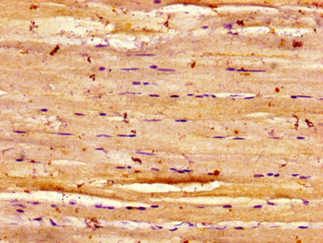 Immunohistochemistry of paraffin-embedded human skeletal muscle tissue using CSB-PA007314LA01HU at dilution of 1:100