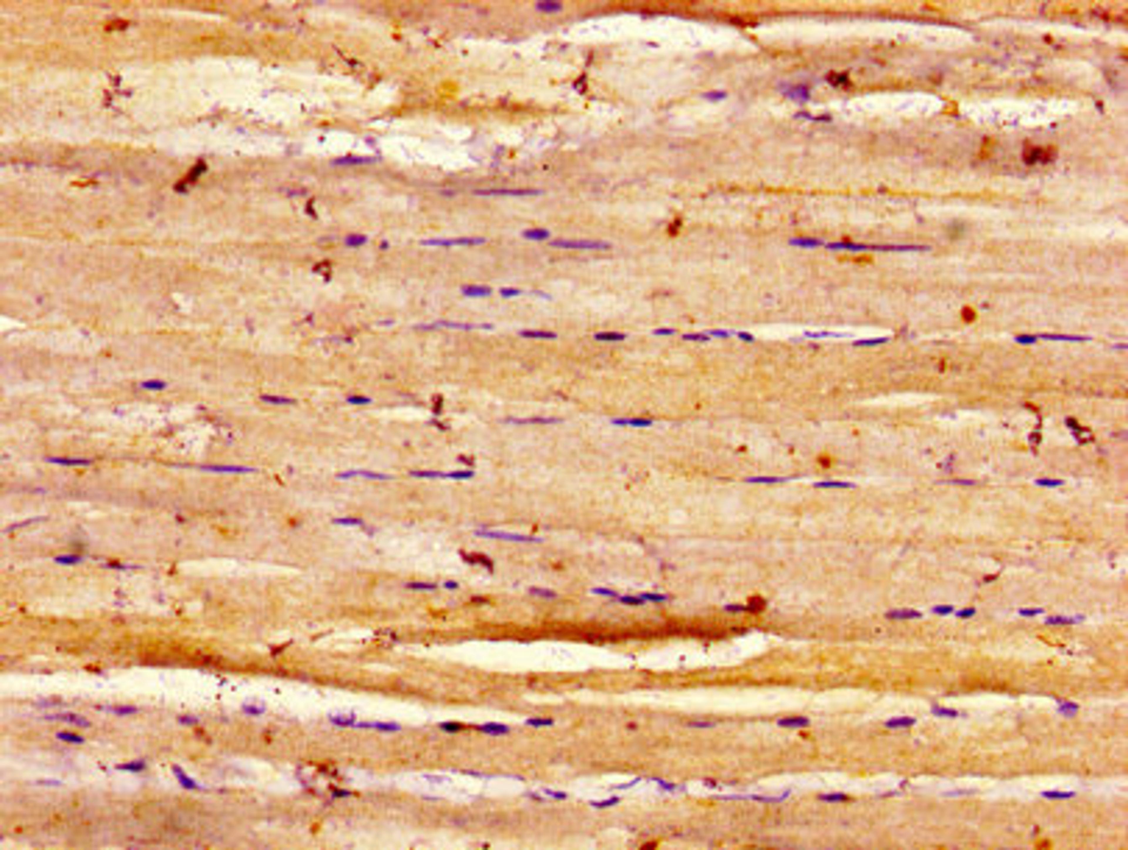 Immunohistochemistry of paraffin-embedded human skeletal muscle tissue using CSB-PA007314LA01HU at dilution of 1:100
