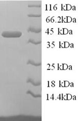 (Tris-Glycine gel) Discontinuous SDS-PAGE (reduced) with 5% enrichment gel and 15% separation gel.