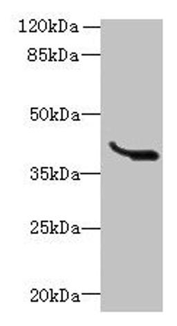 Western blot. All lanes: LRTM1 antibody at 0.4ug/ml + K562 whole cell lysate. Secondary. Goat polyclonal to rabbit IgG at 1/10000 dilution. Predicted band size: 39, 30 kDa. Observed band size: 39 kDa. 