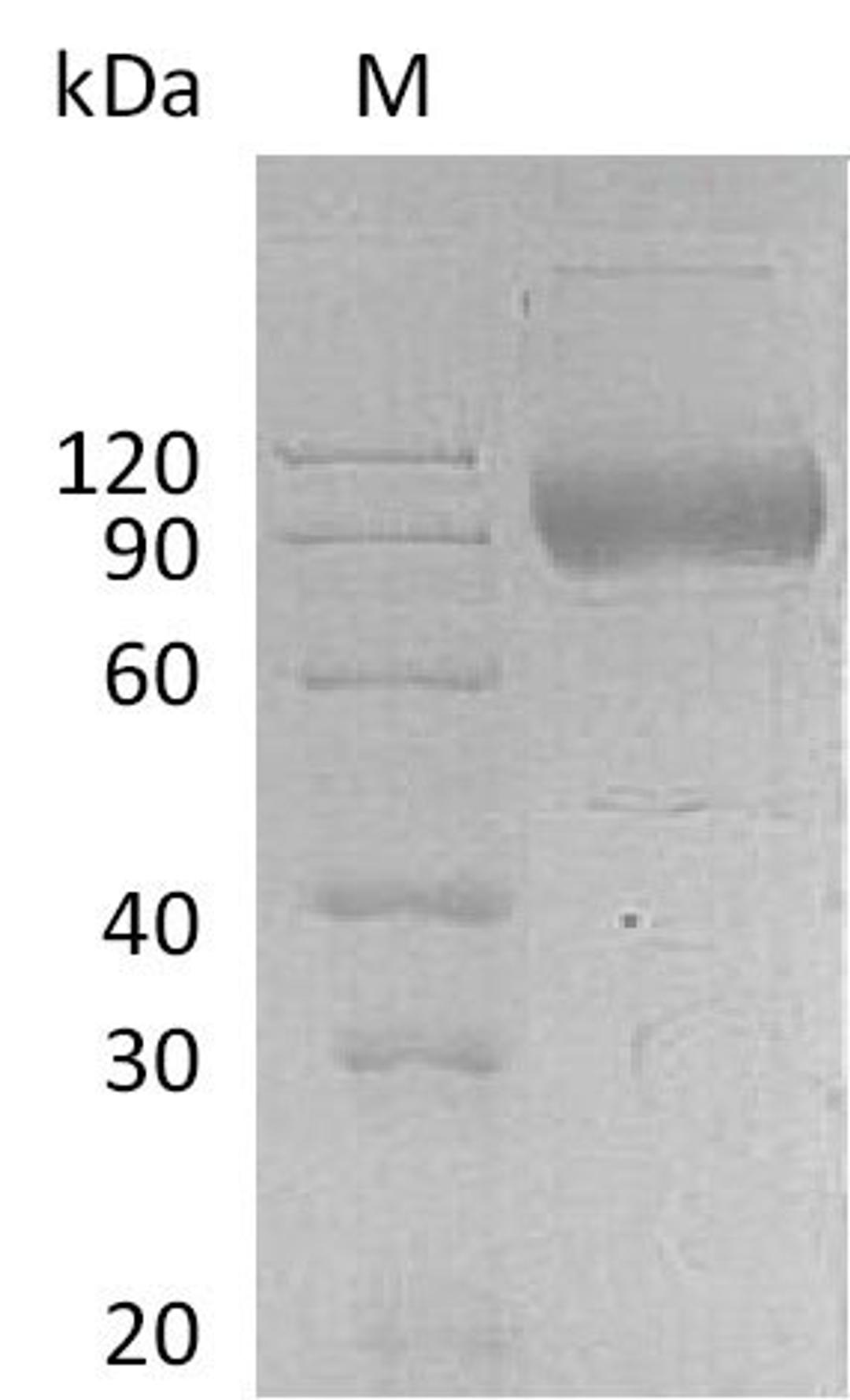 (Tris-Glycine gel) Discontinuous SDS-PAGE (reduced) with 5% enrichment gel and 15% separation gel.