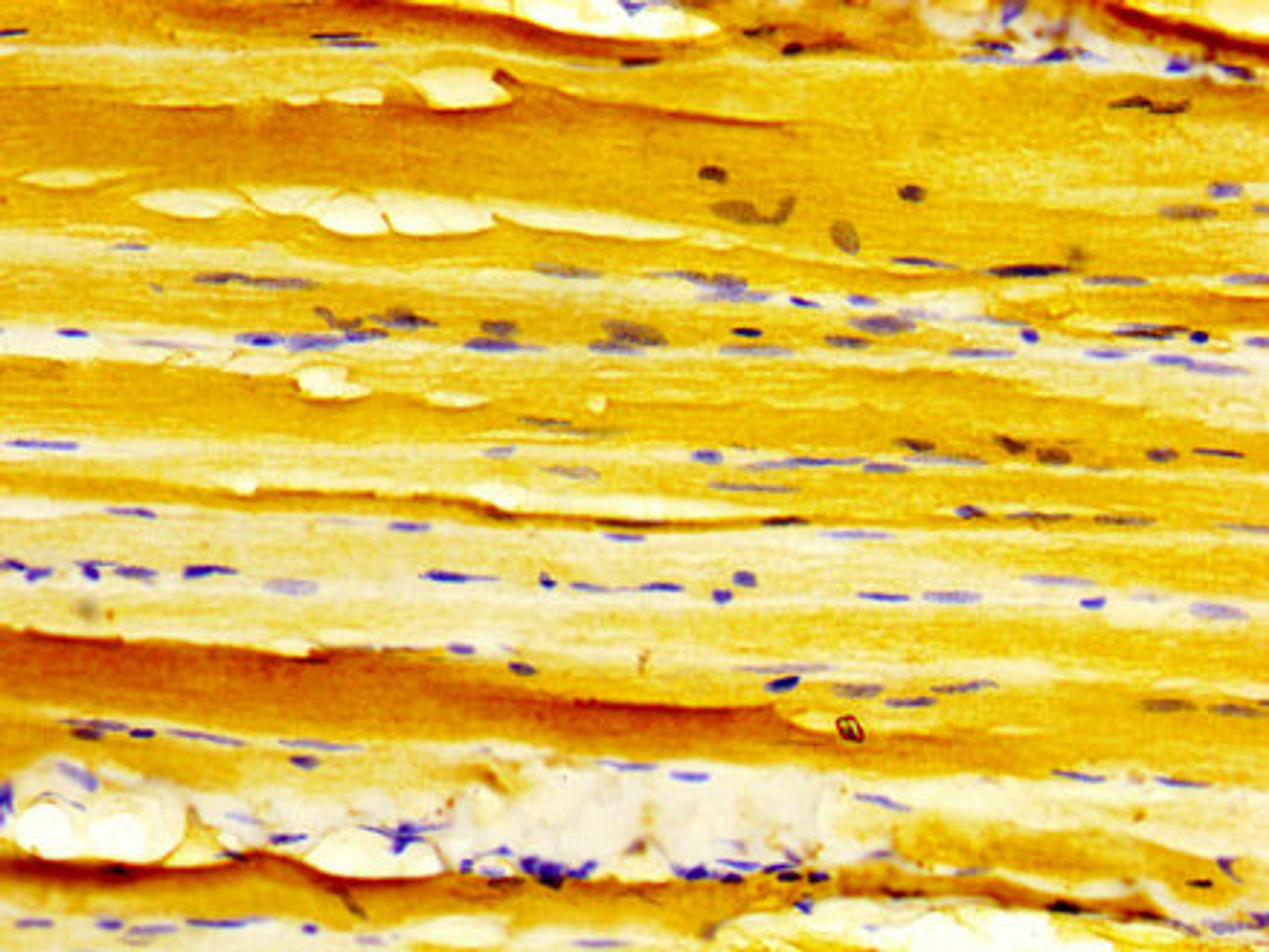 IHC image of CSB-PA006968LA01HU diluted at 1:500 and staining in paraffin-embedded human skeletal muscle tissue performed on a Leica BondTM system. After dewaxing and hydration, antigen retrieval was mediated by high pressure in a citrate buffer (pH 6.0). Section was blocked with 10% normal goat serum 30min at RT. Then primary antibody (1% BSA) was incubated at 4&deg;C overnight. The primary is detected by a biotinylated secondary antibody and visualized using an HRP conjugated SP system.