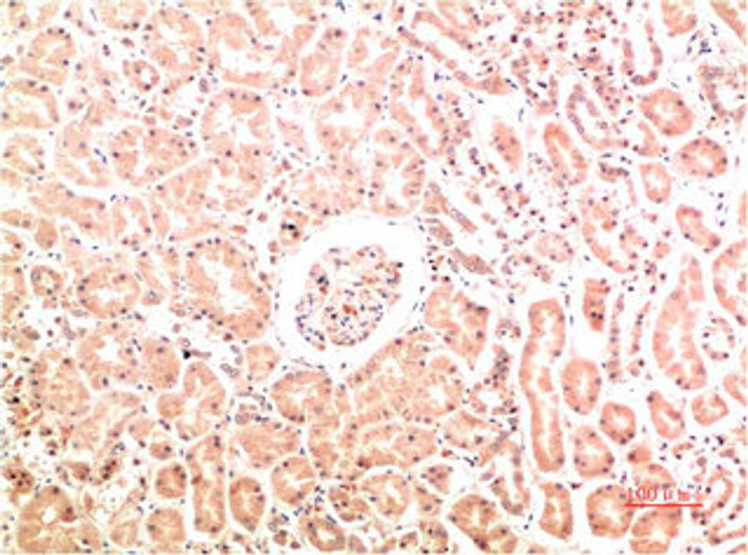 Immunohistochemical analysis of paraffin-embedded Human Kidney Tissue using Collagen IV  Mouse mAb diluted at 1:200.