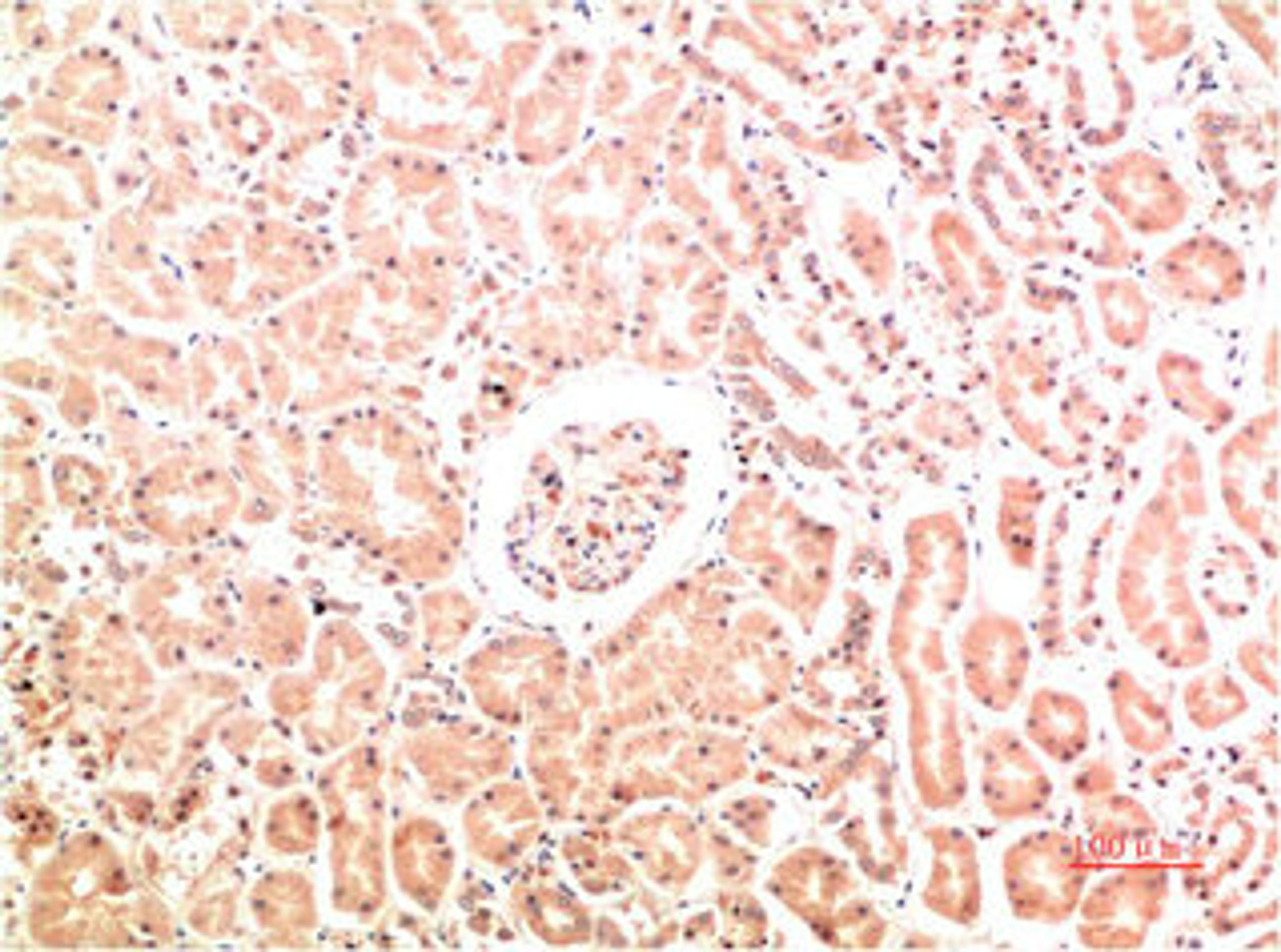 Immunohistochemical analysis of paraffin-embedded Human Kidney Tissue using Collagen IV  Mouse mAb diluted at 1:200.