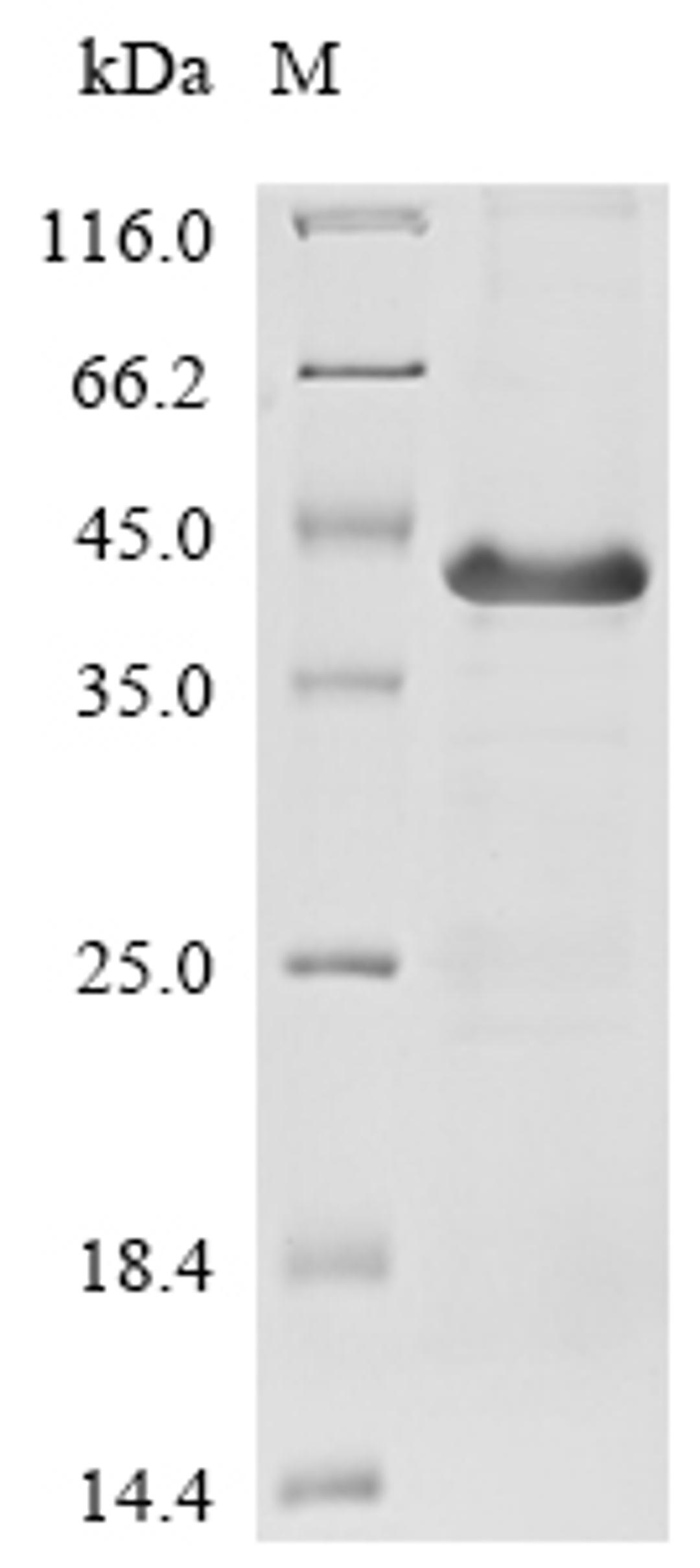 (Tris-Glycine gel) Discontinuous SDS-PAGE (reduced) with 5% enrichment gel and 15% separation gel.