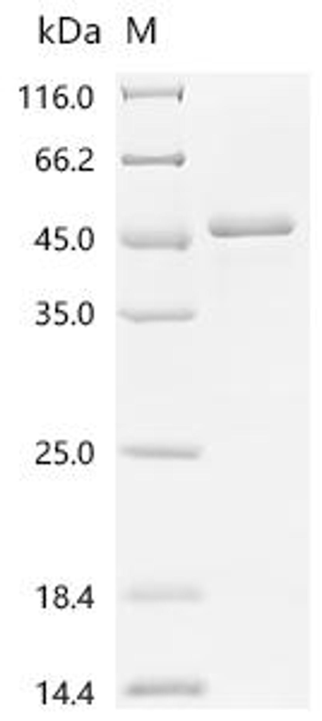 (Tris-Glycine gel) Discontinuous SDS-PAGE (reduced) with 5% enrichment gel and 15% separation gel.