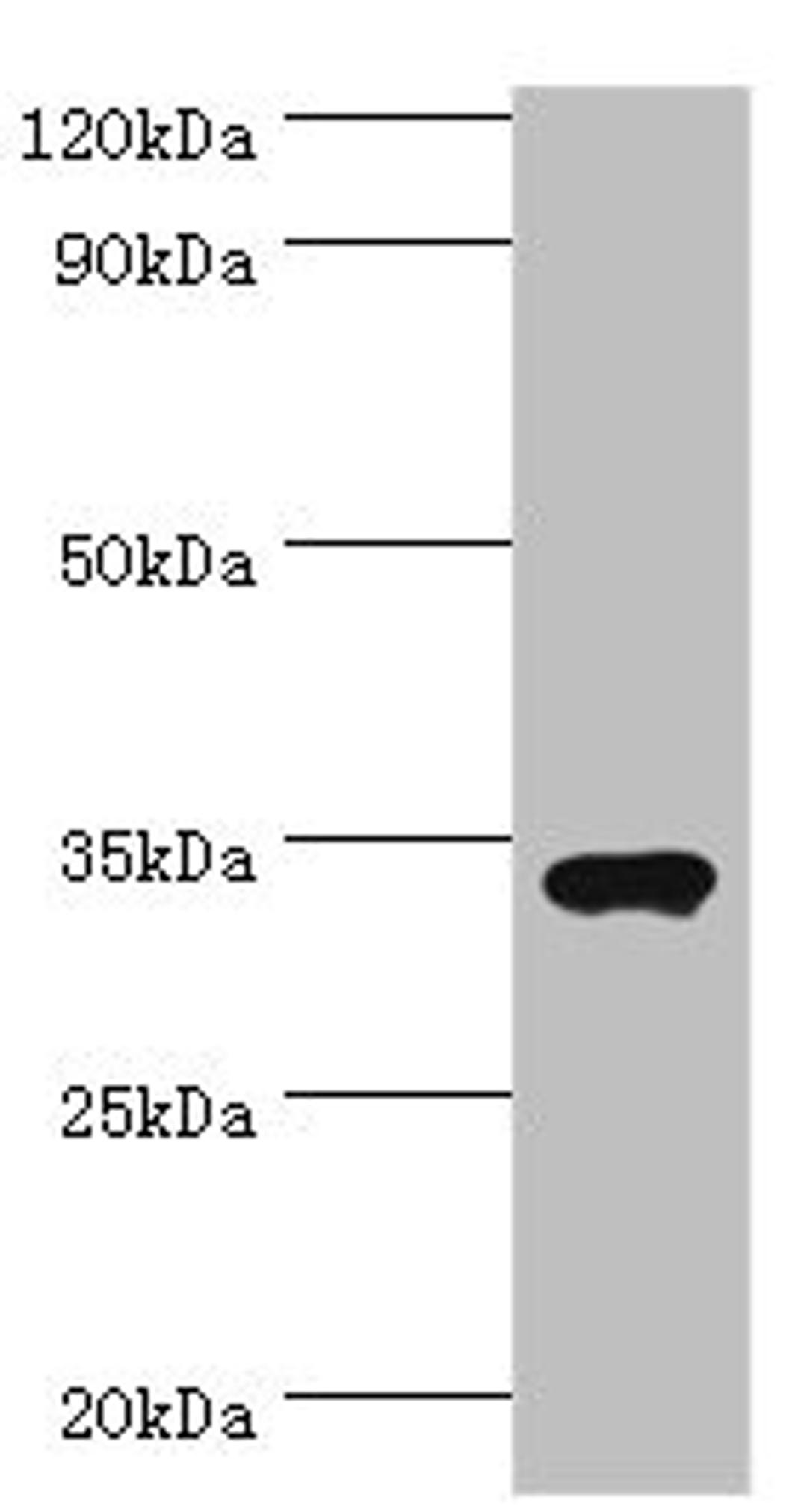 Western blot. All lanes: Sulfotransferase 1A3 antibody at 7ug/ml + A549 whole cell lysate. Secondary. Goat polyclonal to rabbit IgG at 1/10000 dilution. Predicted band size: 35, 23 kDa. Observed band size: 35 kDa. 