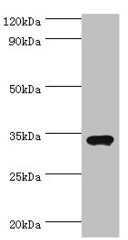 Western blot. All lanes: Sulfotransferase 1A3 antibody at 7ug/ml + A549 whole cell lysate. Secondary. Goat polyclonal to rabbit IgG at 1/10000 dilution. Predicted band size: 35, 23 kDa. Observed band size: 35 kDa. 