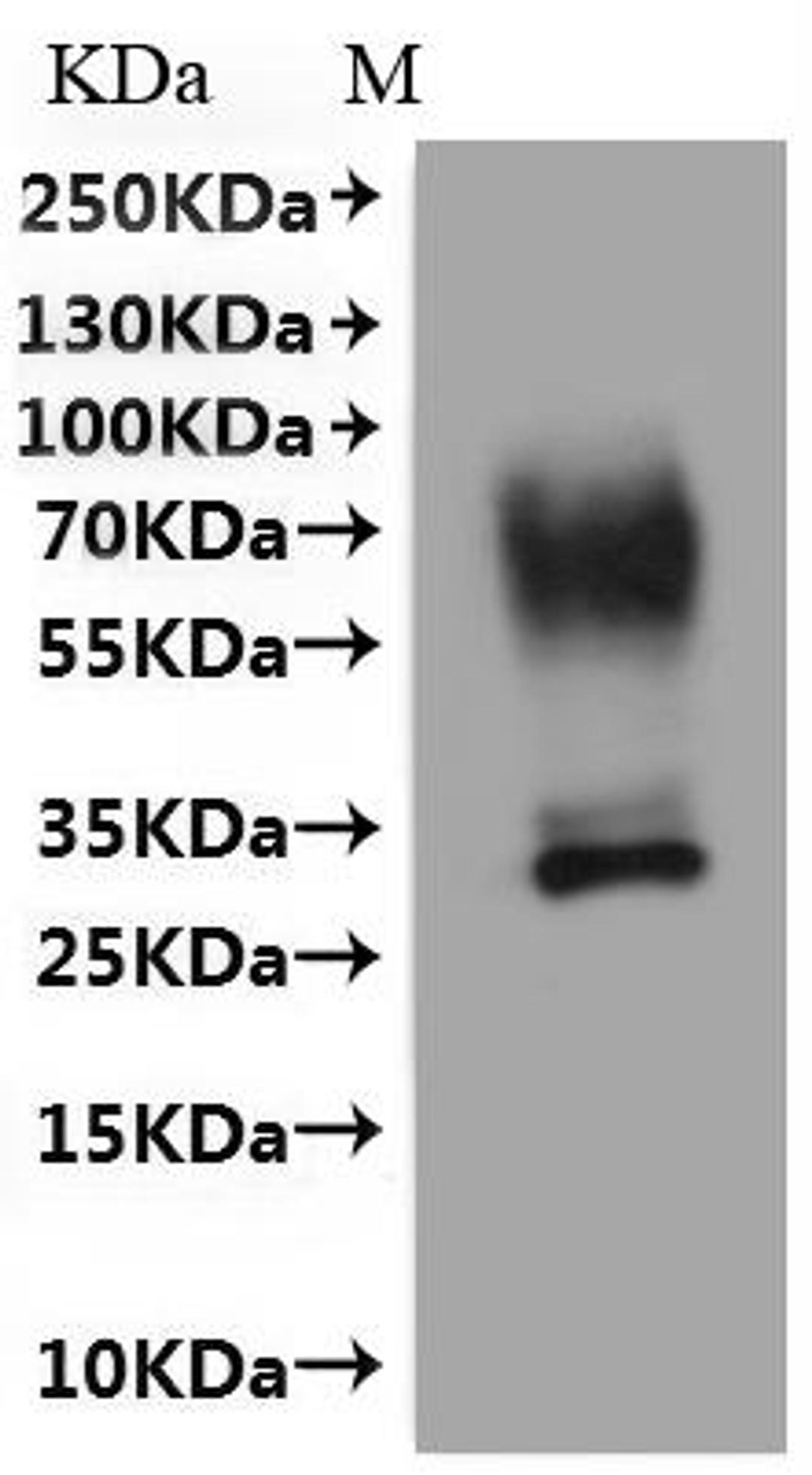 CSB-MP615678HU(A4)-C is detected by Mouse anti-6*His monoclonal antibody.