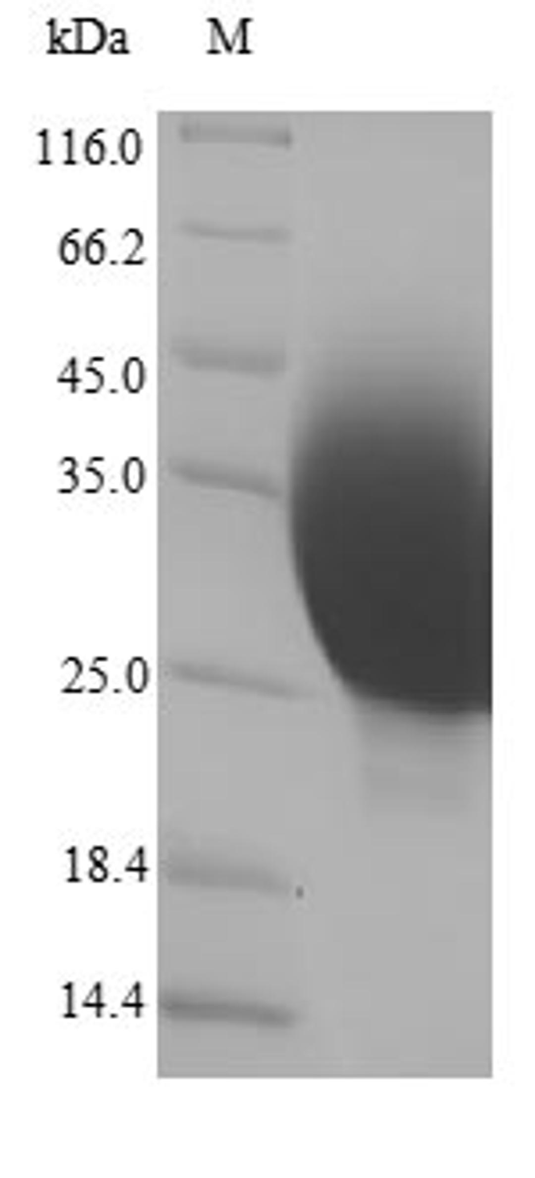 (Tris-Glycine gel) Discontinuous SDS-PAGE (reduced) with 5% enrichment gel and 15% separation gel.