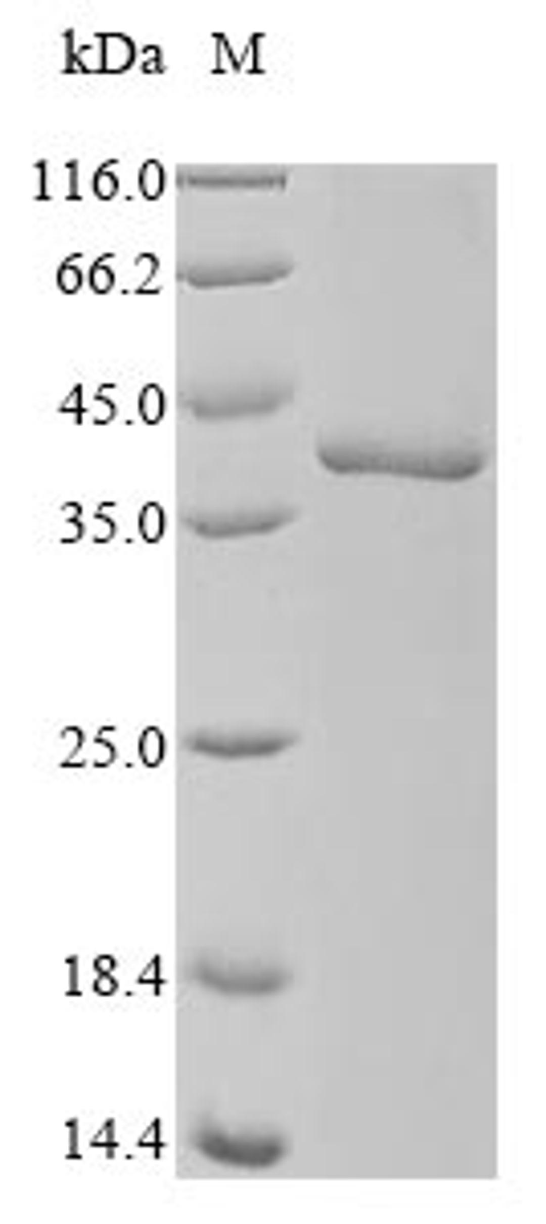 (Tris-Glycine gel) Discontinuous SDS-PAGE (reduced) with 5% enrichment gel and 15% separation gel.