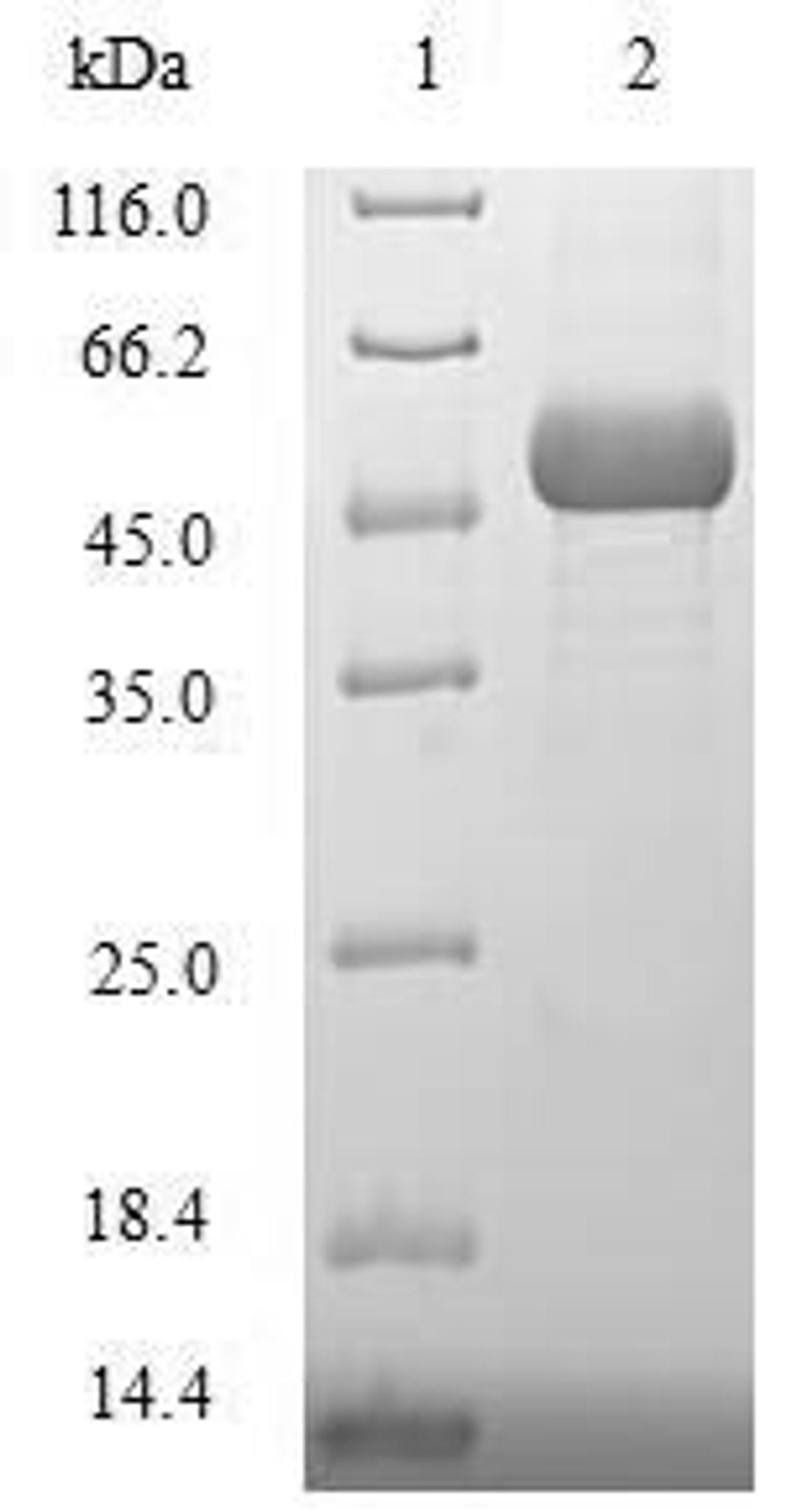 (Tris-Glycine gel) Discontinuous SDS-PAGE (reduced) with 5% enrichment gel and 15% separation gel.