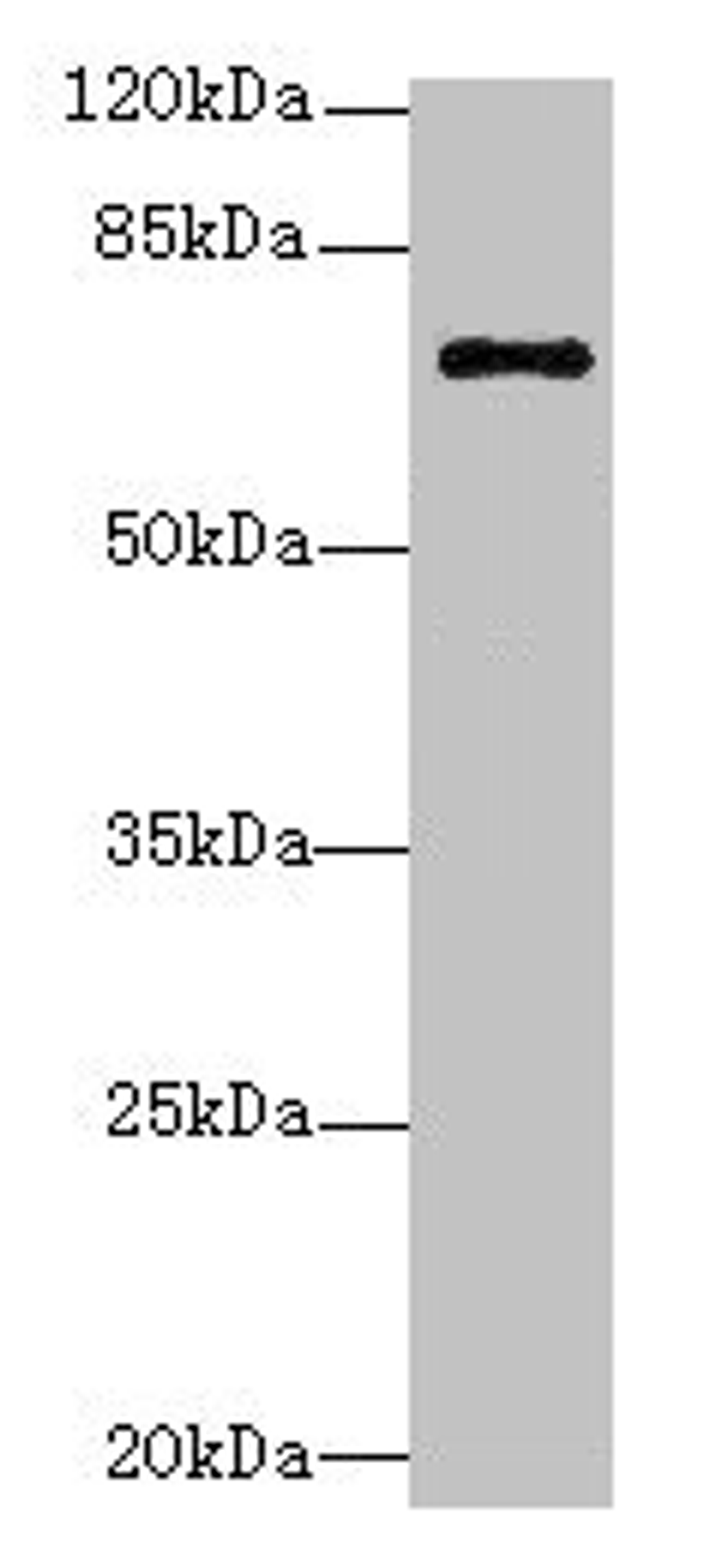 Western blot. All lanes: RHOBTB3 antibody at 12µg/ml + Hela whole cell lysate. Secondary. Goat polyclonal to rabbit IgG at 1/10000 dilution. Predicted band size: 70 kDa. Observed band size: 70 kDa