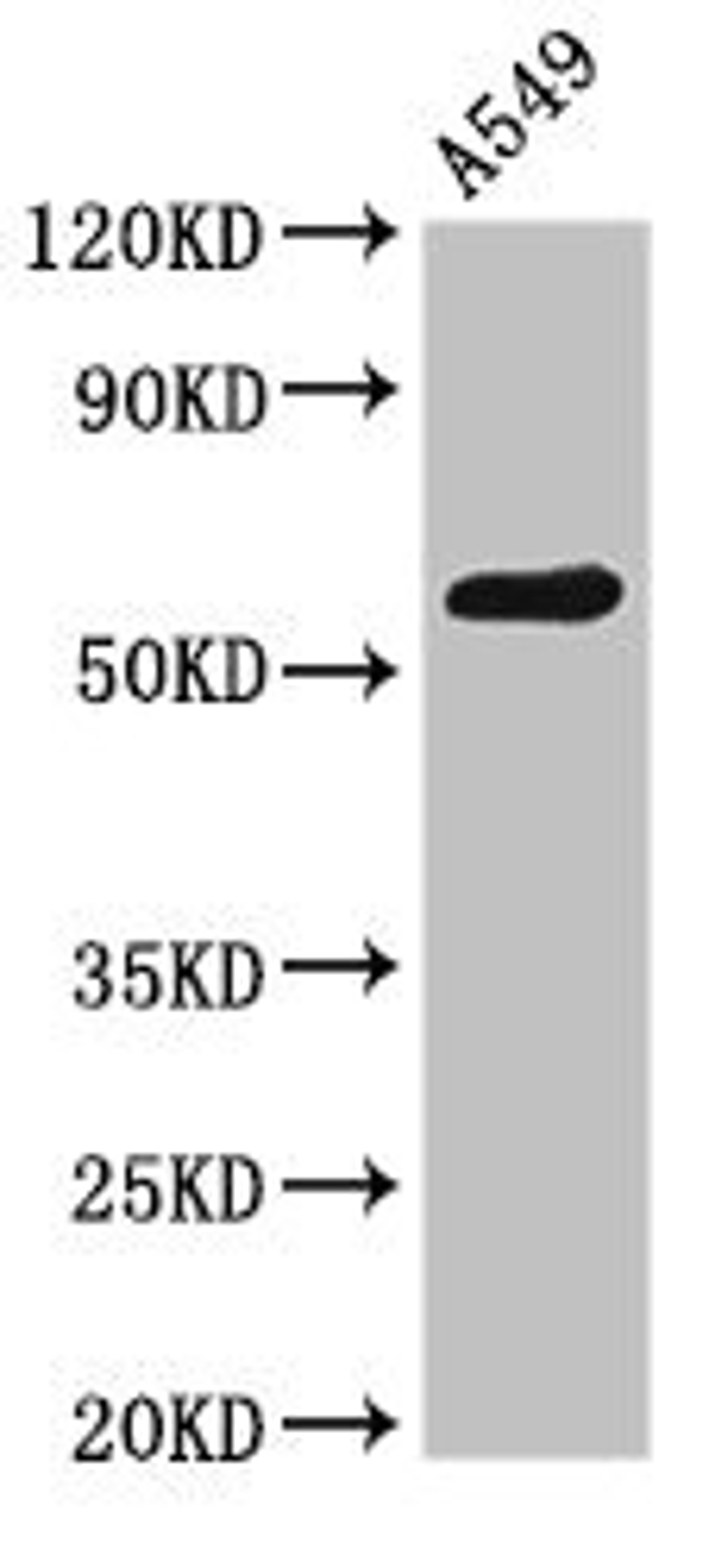 Western Blot. Positive WB detected in: A549 whole cell lysate. All lanes: PODXL antibody at 2.6µg/ml. Secondary. Goat polyclonal to rabbit IgG at 1/50000 dilution. Predicted band size: 59, 56 kDa. Observed band size: 59 kDa