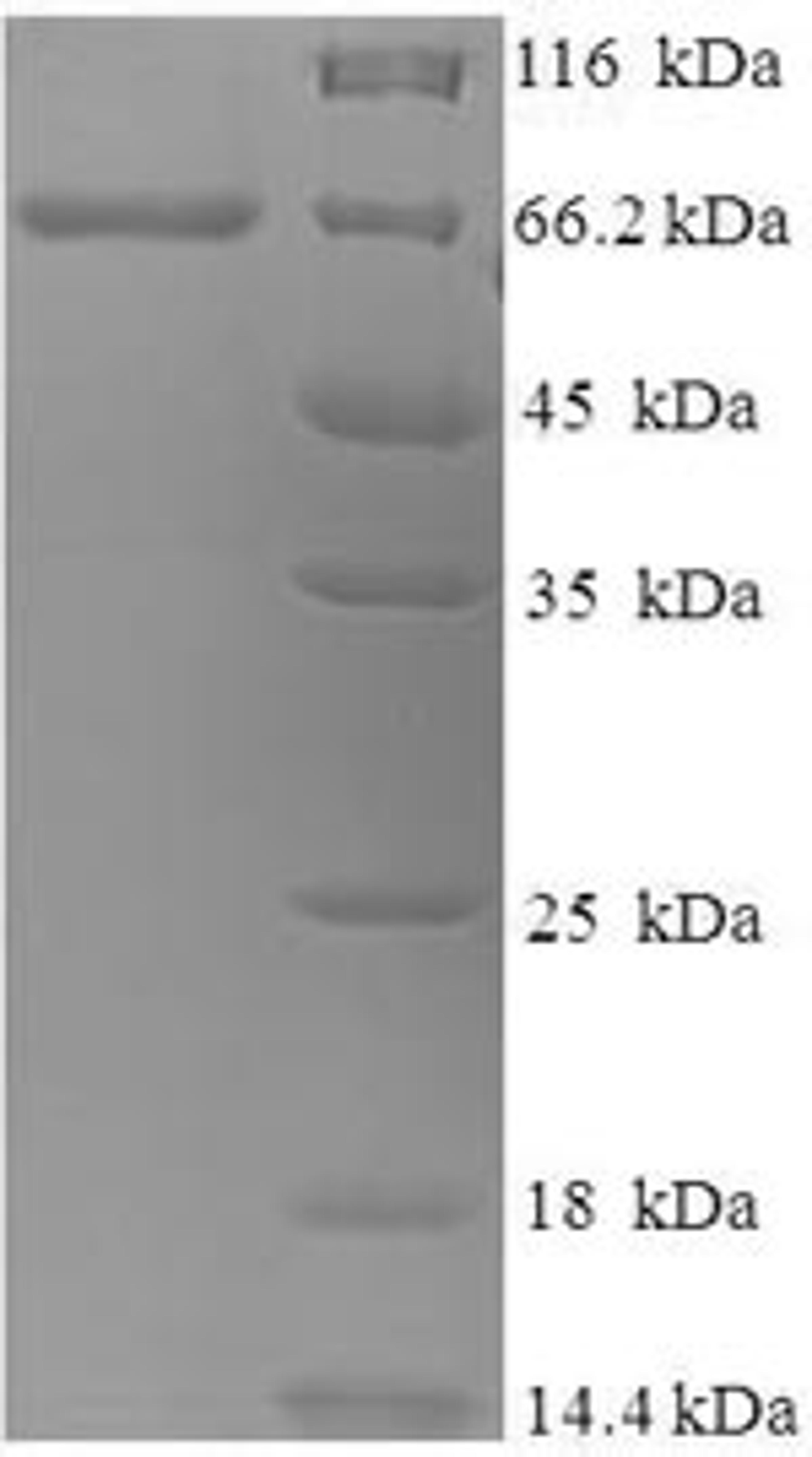 (Tris-Glycine gel) Discontinuous SDS-PAGE (reduced) with 5% enrichment gel and 15% separation gel.