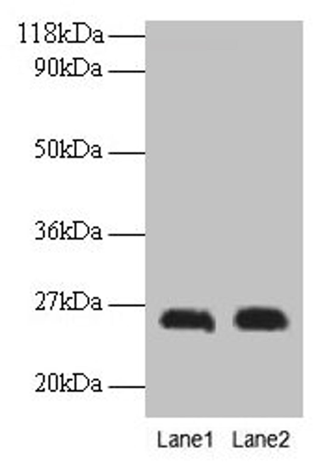 Western blot. All lanes: CSH1 antibody at 2µg/ml. Lane 1: A549 whole cell lysate. Lane 2: U251 whole cell lysate. Secondary. Goat polyclonal to rabbit IgG at 1/15000 dilution. Predicted band size: 26 kDa. Observed band size: 26 kDa