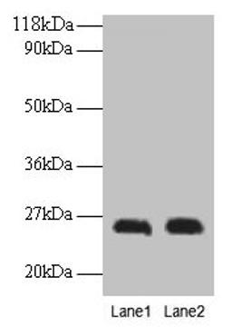 Western blot. All lanes: CSH1 antibody at 2µg/ml. Lane 1: A549 whole cell lysate. Lane 2: U251 whole cell lysate. Secondary. Goat polyclonal to rabbit IgG at 1/15000 dilution. Predicted band size: 26 kDa. Observed band size: 26 kDa