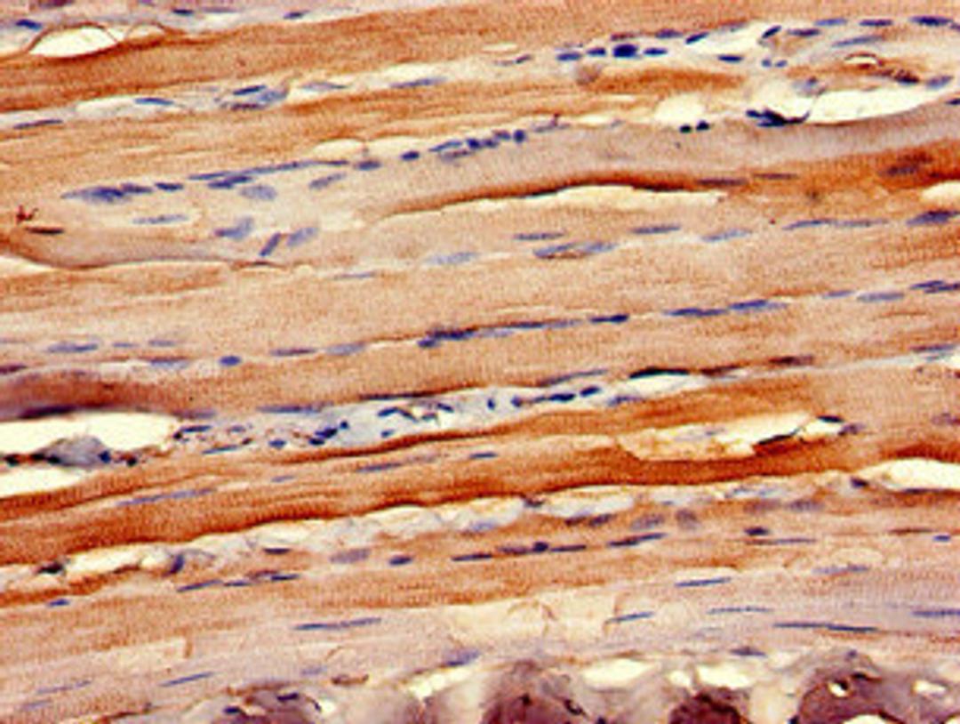 Immunohistochemistry of paraffin-embedded human skeletal muscle tissue using CSB-PA004840LA01HU at dilution of 1:100