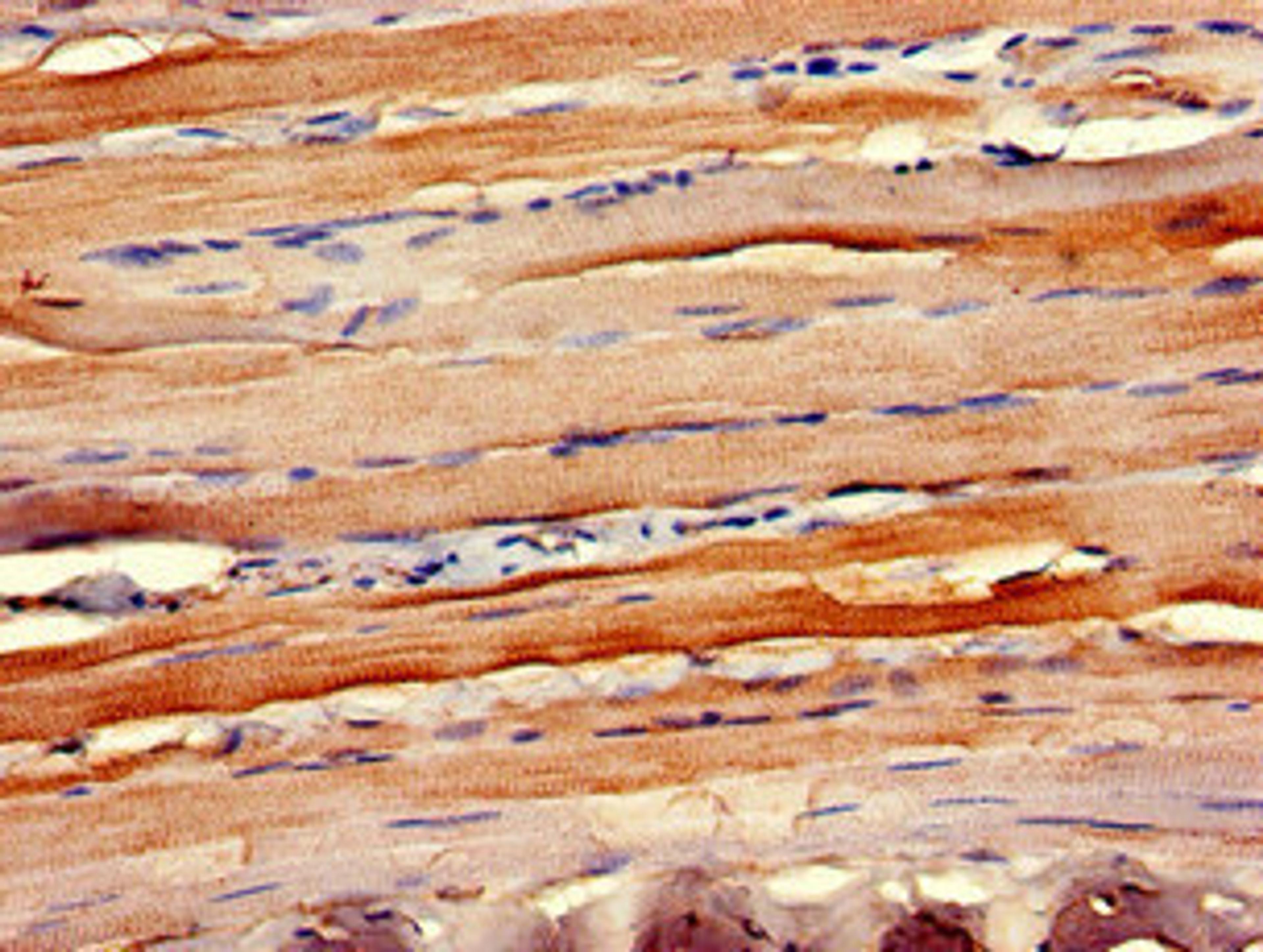 Immunohistochemistry of paraffin-embedded human skeletal muscle tissue using CSB-PA004840LA01HU at dilution of 1:100