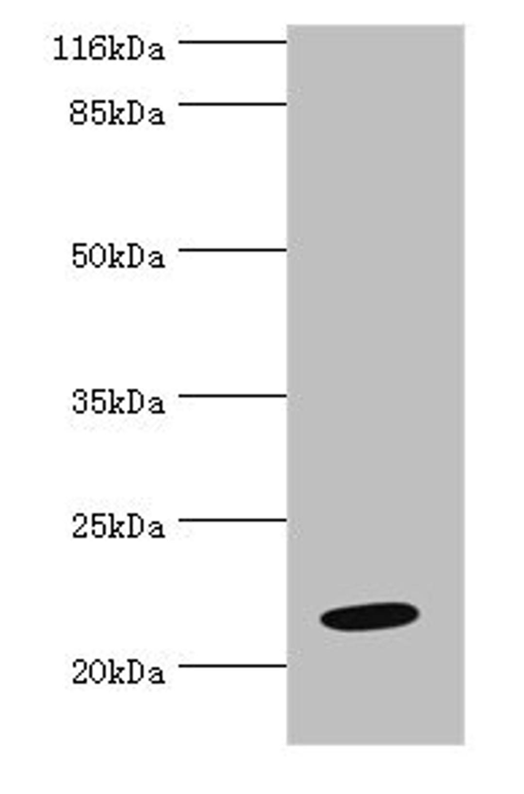 Western blot. All lanes: NME6 antibody at 2µg/ml + Hela whole cell lysate. Secondary. Goat polyclonal to rabbit IgG at 1/10000 dilution. Predicted band size: 22, 14, 19 kDa. Observed band size: 22 kDa