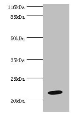 Western blot. All lanes: NME6 antibody at 2µg/ml + Hela whole cell lysate. Secondary. Goat polyclonal to rabbit IgG at 1/10000 dilution. Predicted band size: 22, 14, 19 kDa. Observed band size: 22 kDa