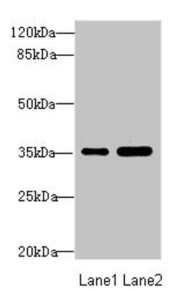 Western blot. All lanes: TOB2 antibody at 1.89ug/ml. Lane 1: Mouse skeletal muscle tissue. Lane 2: Mouse heart tissue. Secondary. Goat polyclonal to rabbit IgG at 1/10000 dilution. Predicted band size: 37, 28 kDa. Observed band size: 37 kDa. 