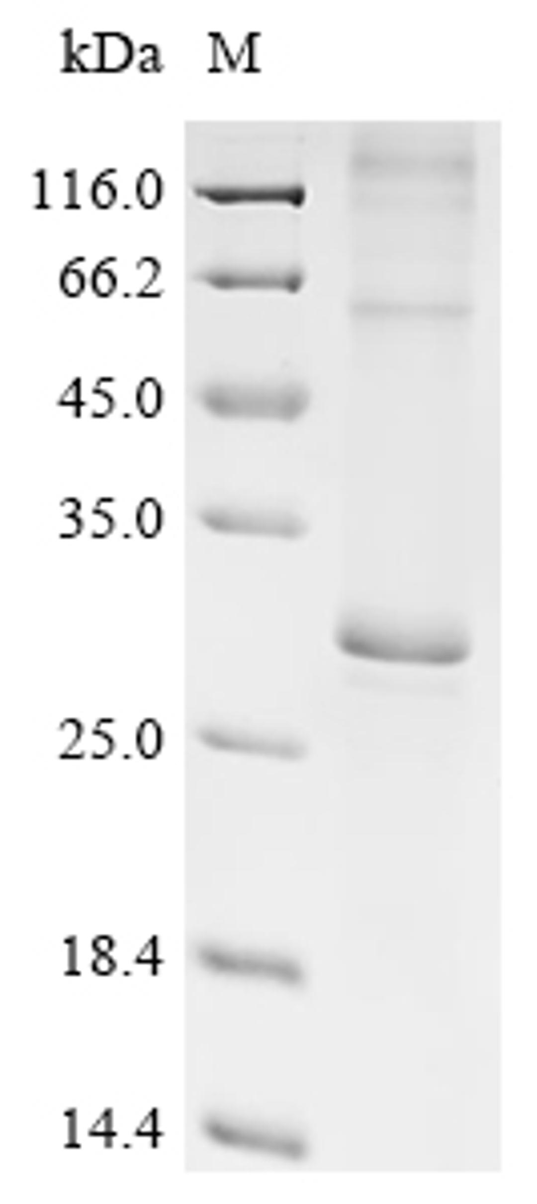 (Tris-Glycine gel) Discontinuous SDS-PAGE (reduced) with 5% enrichment gel and 15% separation gel.