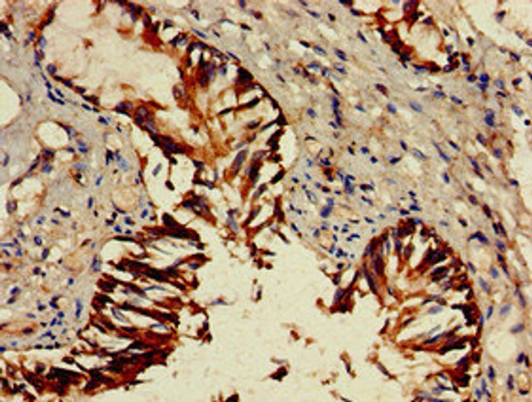 Immunohistochemistry of paraffin-embedded human lung tissue using CSB-PA010085LA01HU at dilution of 1:100