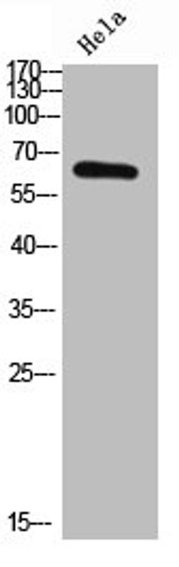 Western Blot analysis of hela cells using NFκB-p65 Polyclonal Antibody