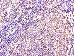 Immunohistochemistry of paraffin-embedded human lymph node tissue using CSB-PA011673HA01HU at dilution of 1:100