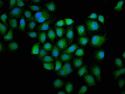Immunofluorescence staining of Hela cells with CSB-PA009965HA01HU at 1:100, counter-stained with DAPI. The cells were fixed in 4% formaldehyde, permeabilized using 0.2% Triton X-100 and blocked in 10% normal Goat Serum. The cells were then incubated with the antibody overnight at 4&deg;C. The secondary antibody was Alexa Fluor 488-congugated AffiniPure Goat Anti-Rabbit IgG(H+L).