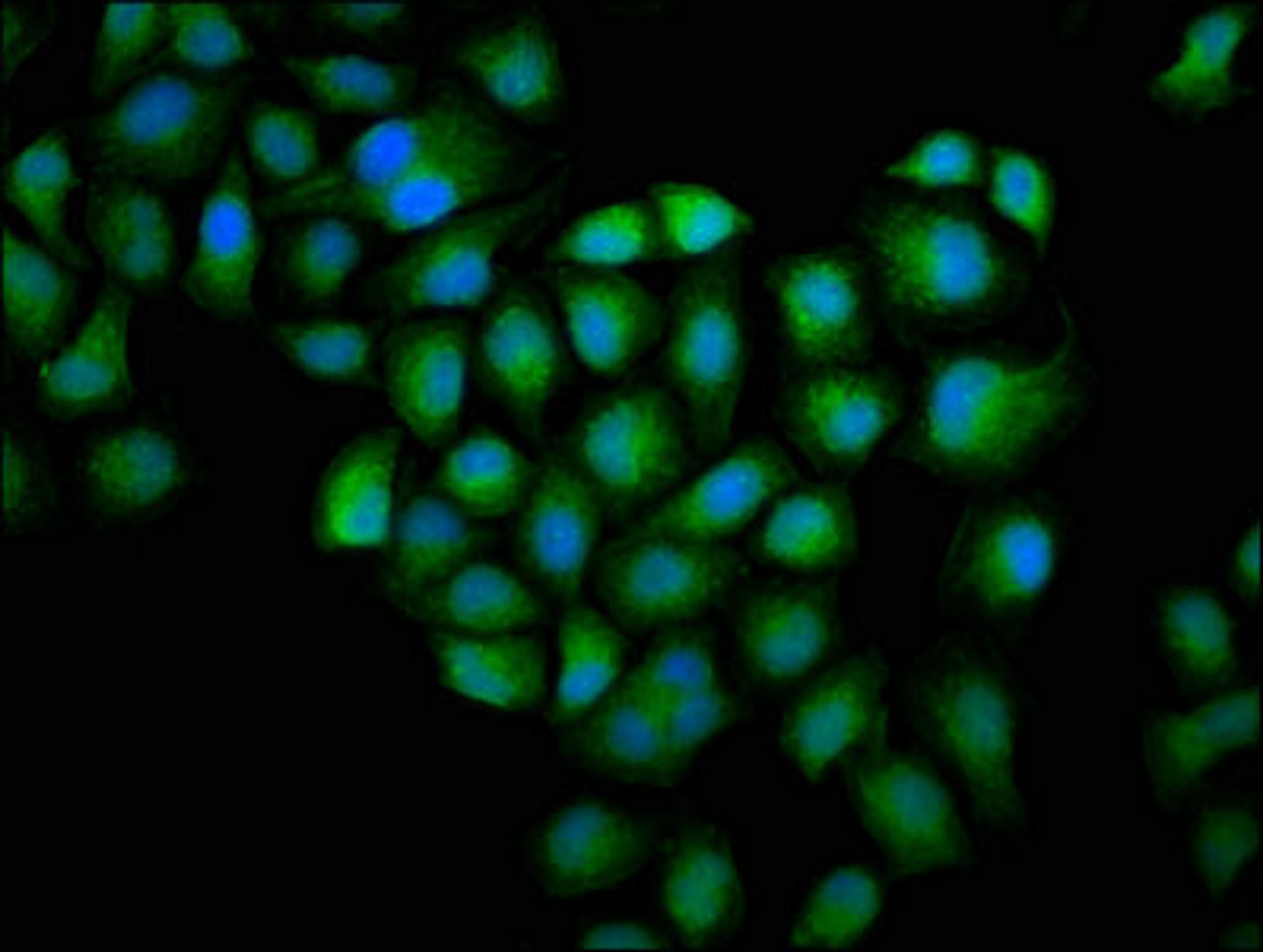 Immunofluorescence staining of Hela cells with CSB-PA009965HA01HU at 1:100, counter-stained with DAPI. The cells were fixed in 4% formaldehyde, permeabilized using 0.2% Triton X-100 and blocked in 10% normal Goat Serum. The cells were then incubated with the antibody overnight at 4°C. The secondary antibody was Alexa Fluor 488-congugated AffiniPure Goat Anti-Rabbit IgG(H+L).