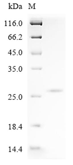 (Tris-Glycine gel) Discontinuous SDS-PAGE (reduced) with 5% enrichment gel and 15% separation gel.