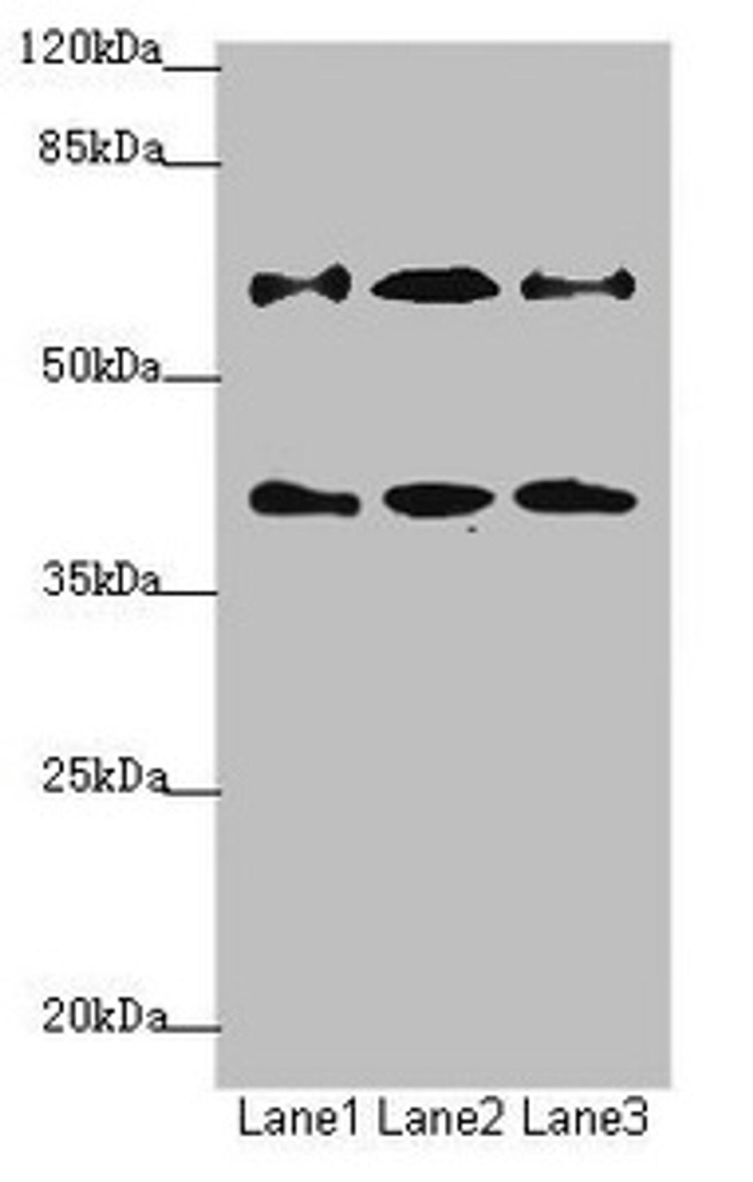 Western blot. All lanes: DCP1A antibody at 1.23ug/ml. Lane 1: Jurkat whole cell lysate. Lane 2: 293T whole cell lysate. Lane 3: HepG2 whole cell lysate. Secondary. Goat polyclonal to rabbit IgG at 1/10000 dilution. Predicted band size: 64, 60 kDa. Observed band size: 64, 40 kDa. 
